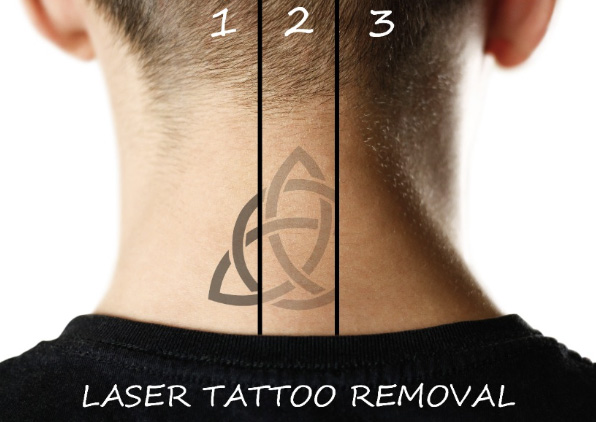 tatoutage nuque