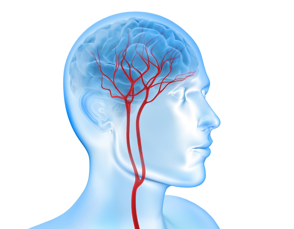 Les particules toxiques inhalées passent directement des poumons au cerveau, en passant par le sang (Visuel Adobe Stock 101804429)