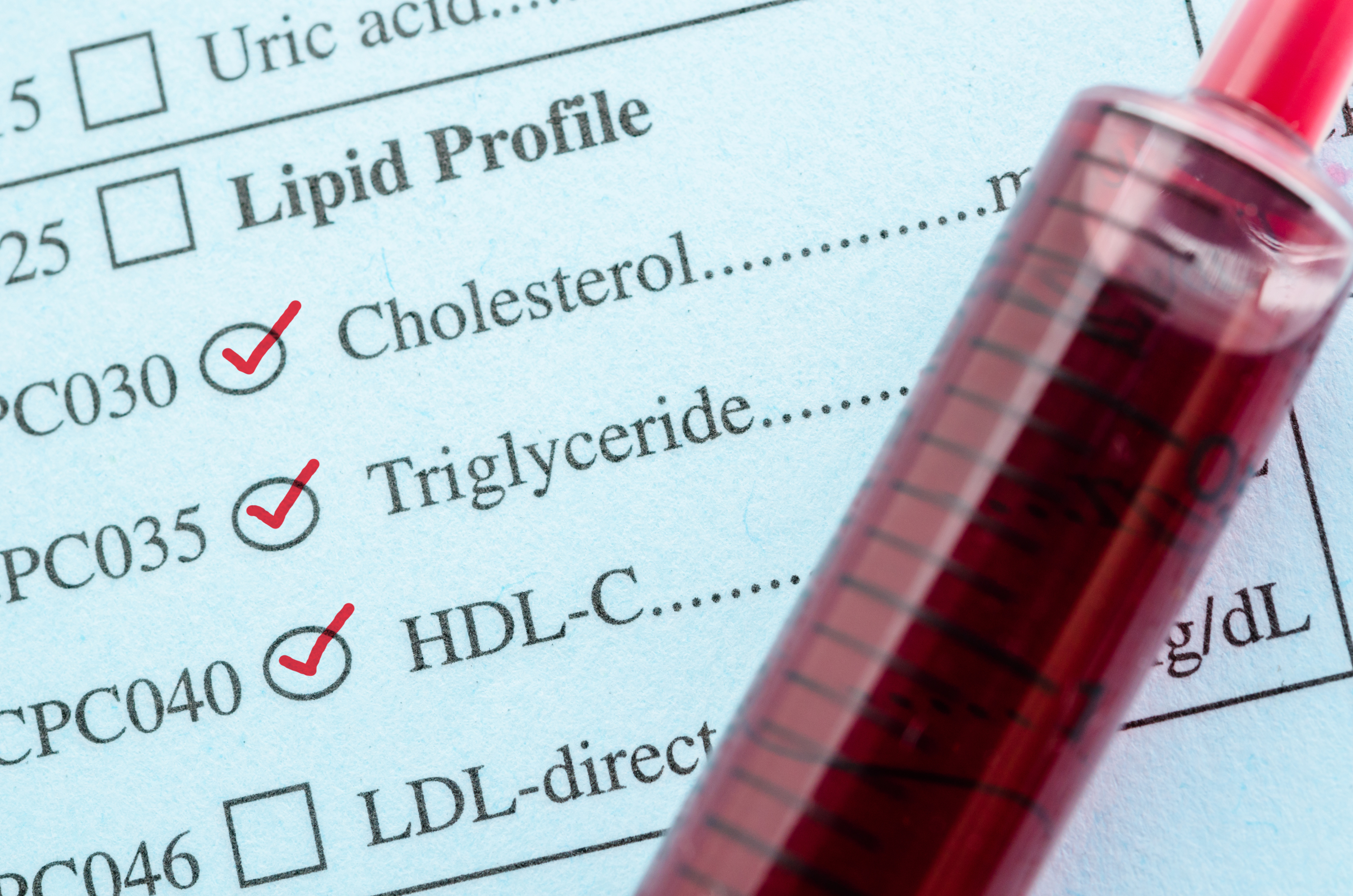 La réduction des triglycérides ne semble avoir aucun effet significatif de réduction des événements cardiovasculaires (Visuel Adobe Stock 111046439)