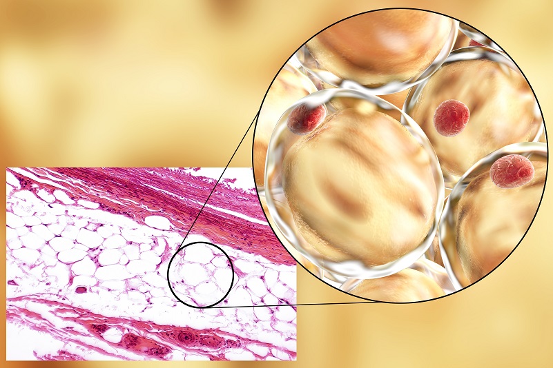 L'acétylation d’un récepteur de l’adipogenèse dans les macrophages du tissu adipeux favorise l’accumulation de graisse et le développement de l’obésité (Visuel Adobe Stock 114434474)