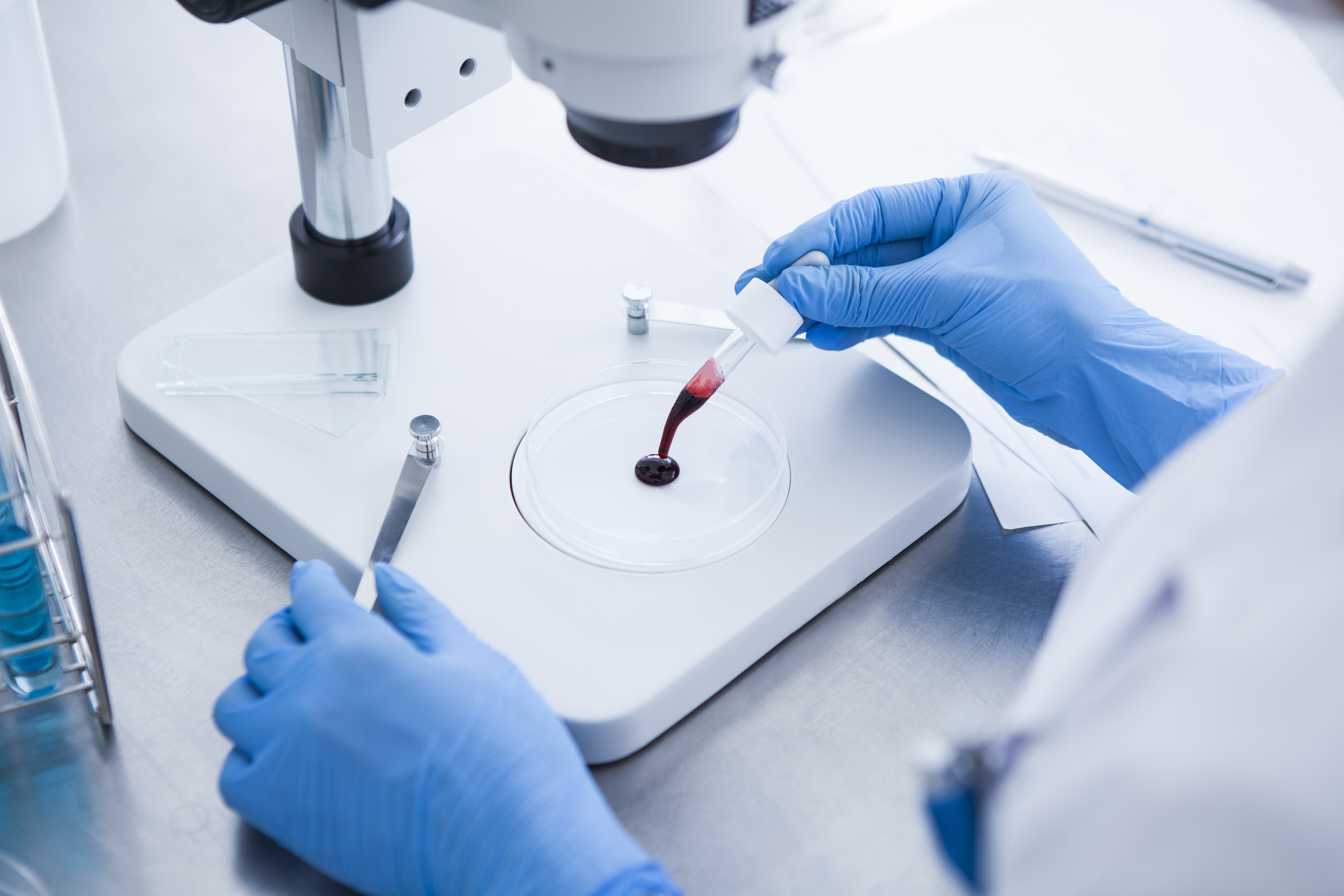 L’utilisation des biomarqueurs sanguins objectifs de l'apport en flavanols à grande échelle permet d'éviter les limites importantes qui accompagnent habituellement les recherches en nutrition (Visuel Adobe Stock 114589392) L’utilisation des biomarqueurs sanguins objectifs de l'apport en flavanols à grande échelle permet d'éviter les limites importantes qui accompagnent habituellement les recherches en nutrition (Visuel Adobe Stock 114589392)