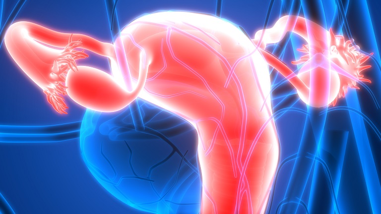 Les symptômes du syndrome des ovaires polykystiques apparaissent en corrélation avec la composition bactérienne intestinale