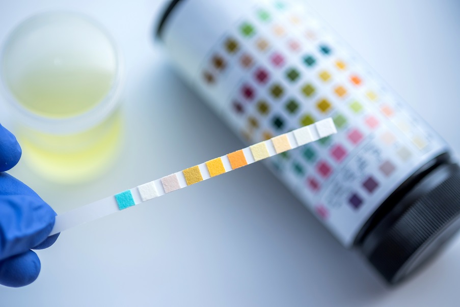 Ce test pourrait même prédire, à partir de cette signature « métabolique », le risque d'obésité, de diabète et/ou d'hypertension artérielle (Visuel AdobeStock_123246503) Ce test pourrait même prédire, à partir de cette signature « métabolique », le risque d'obésité, de diabète et/ou d'hypertension artérielle (Visuel AdobeStock_123246503)