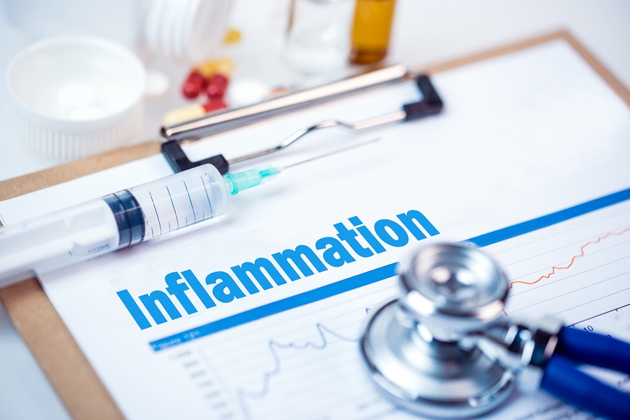 On sait que l’inflammation est la première étape, normale et naturelle de la réponse immunitaire, on connait moins bien le mécanisme qui y met fin  (Visuel Adobe Stock 136261201)
