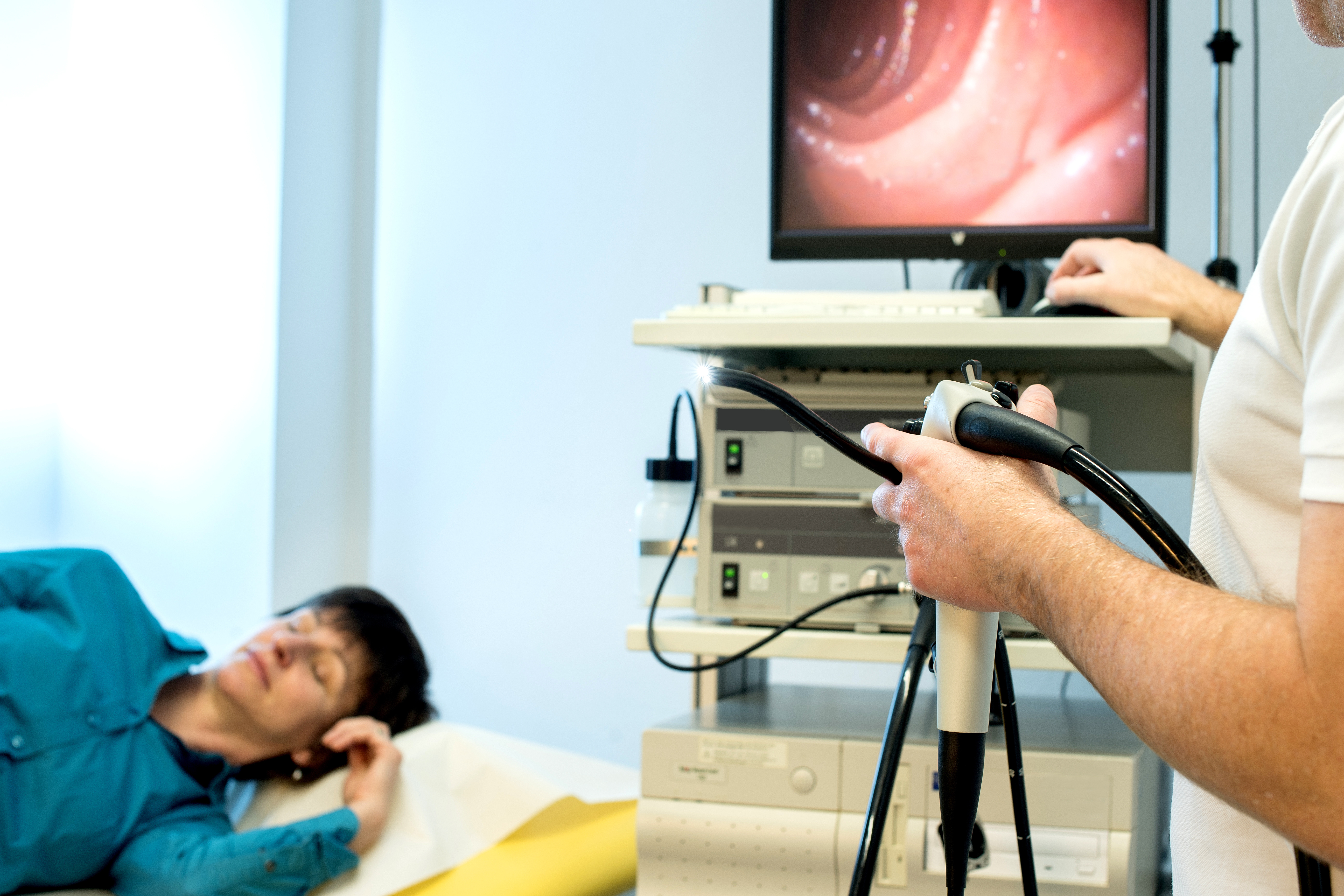 Cette biopsie liquide permet une prédiction robuste de la réponse au traitement néoadjuvant (NAT) chez les patients atteints de cancer de l’œsophage et avant la chirurgie (Visuel Adobe Stock 136913919)