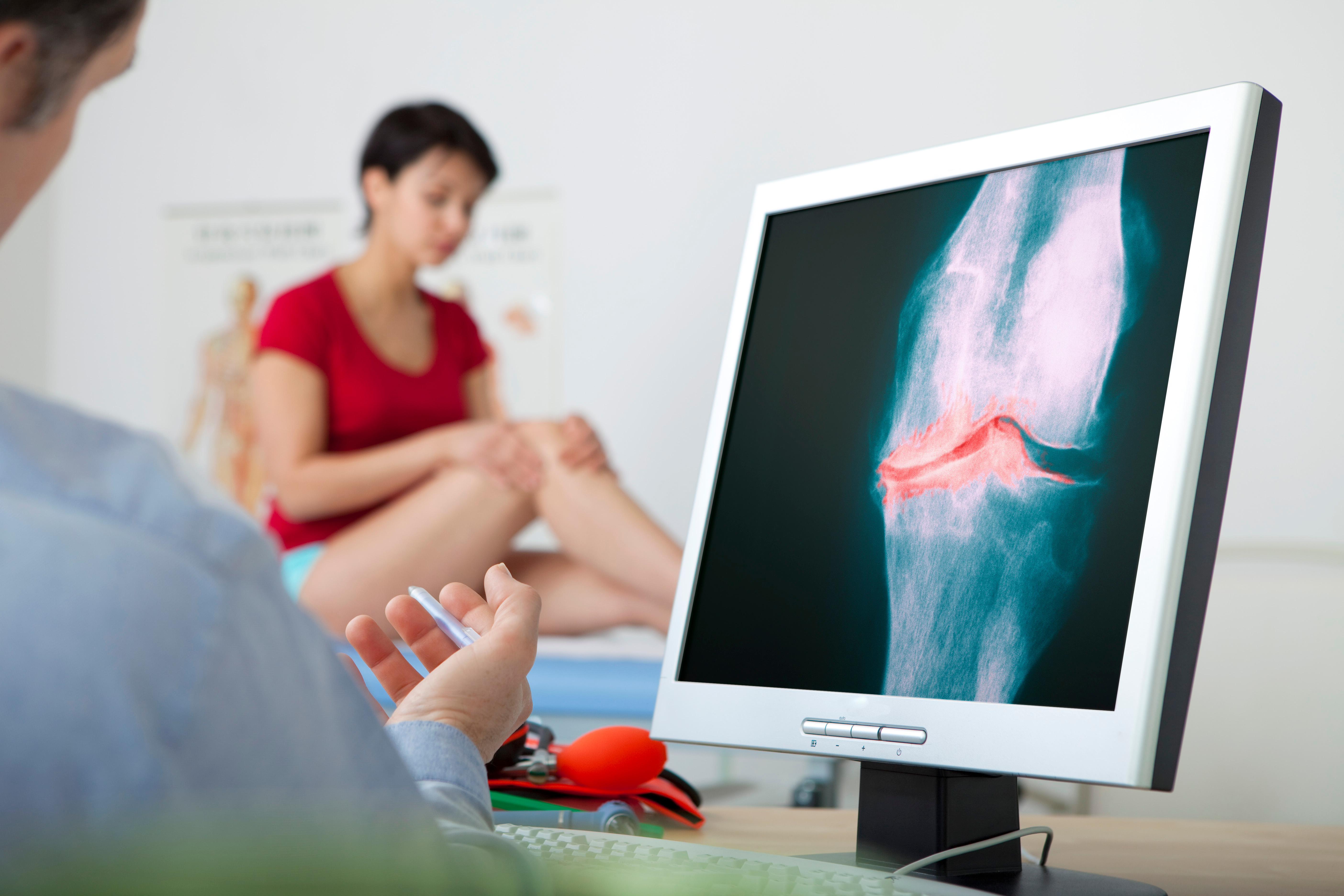 La greffe de cellules souches est-elle bénéfique pour les patients souffrant d'arthrose du genou ?  (Visuel Adobe Stock 158960700)
