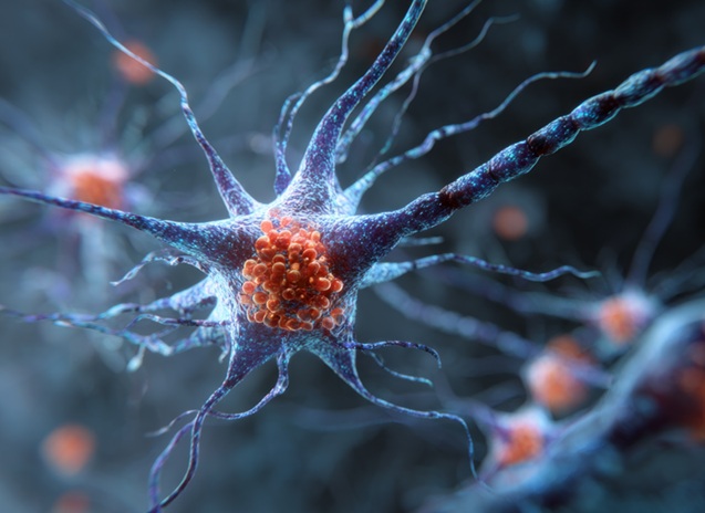 Une exposition chronique de 9 jours au fer de neurones humains en culture induit un nouveau mécanisme de stress cellulaire, nommé chronoferroptose (Visuel Adobe Stock 1690072189) Une exposition chronique de 9 jours au fer de neurones humains en culture induit un nouveau mécanisme de stress cellulaire, nommé chronoferroptose (Visuel Adobe Stock 1690072189)