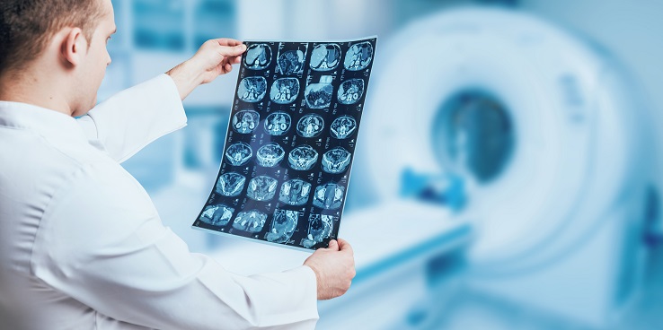 En bloquant la réponse cellulaire à ce flux, c’est une toute nouvelle option, à partir d’un médicament déjà disponible, prometteuse pour enrayer la propagation du cancer du cerveau. En bloquant la réponse cellulaire à ce flux, c’est une toute nouvelle option, à partir d’un médicament déjà disponible, prometteuse pour enrayer la propagation du cancer du cerveau.