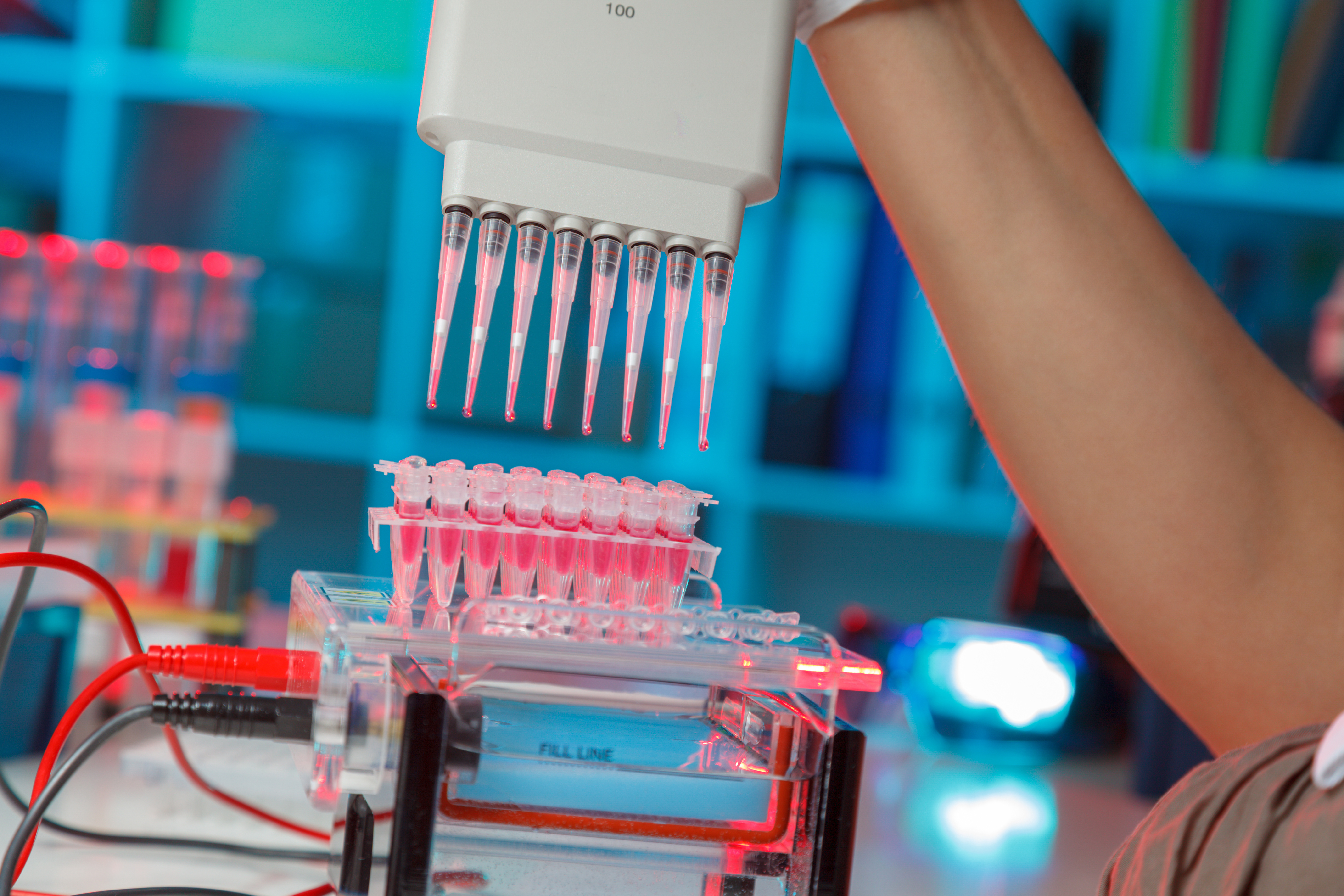 Lorsqu'une thérapie spécifique de l’AVC est liée à un type spécifique de lipide et injectée dans le sang, elle est alors absorbée préférentiellement dans le cerveau et la lésion causée par l'AVC (Visuel Adobe Stock 187174949) Lorsqu'une thérapie spécifique de l’AVC est liée à un type spécifique de lipide et injectée dans le sang, elle est alors absorbée préférentiellement dans le cerveau et la lésion causée par l'AVC (Visuel Adobe Stock 187174949)