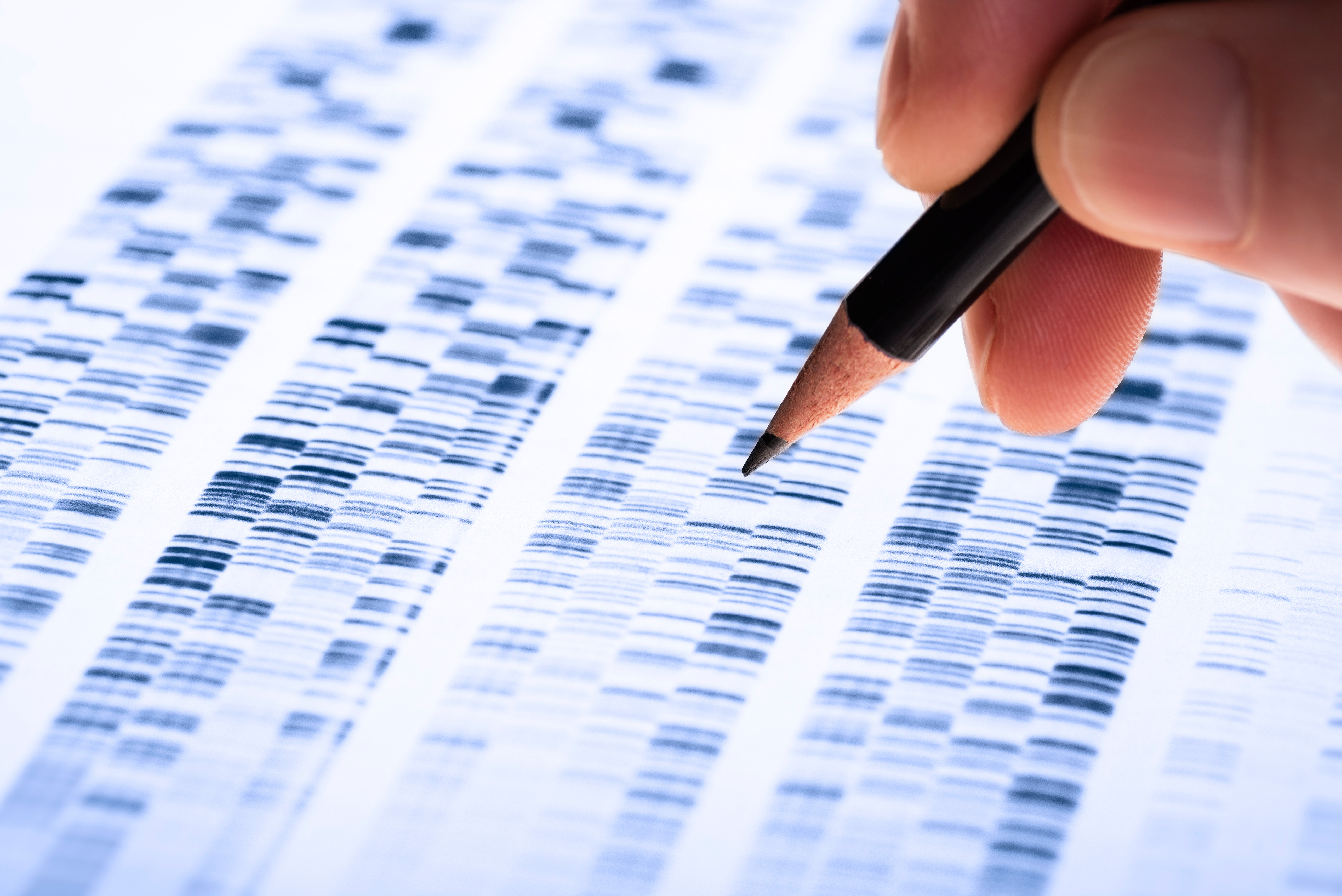 2 maladies neurologiques pourtant cliniquement très différentes, la dépression et la maladie d'Alzheimer, partagent de mêmes racines génétiques (Adobe Stock 195001585) 2 maladies neurologiques pourtant cliniquement très différentes, la dépression et la maladie d'Alzheimer, partagent de mêmes racines génétiques (Adobe Stock 195001585)