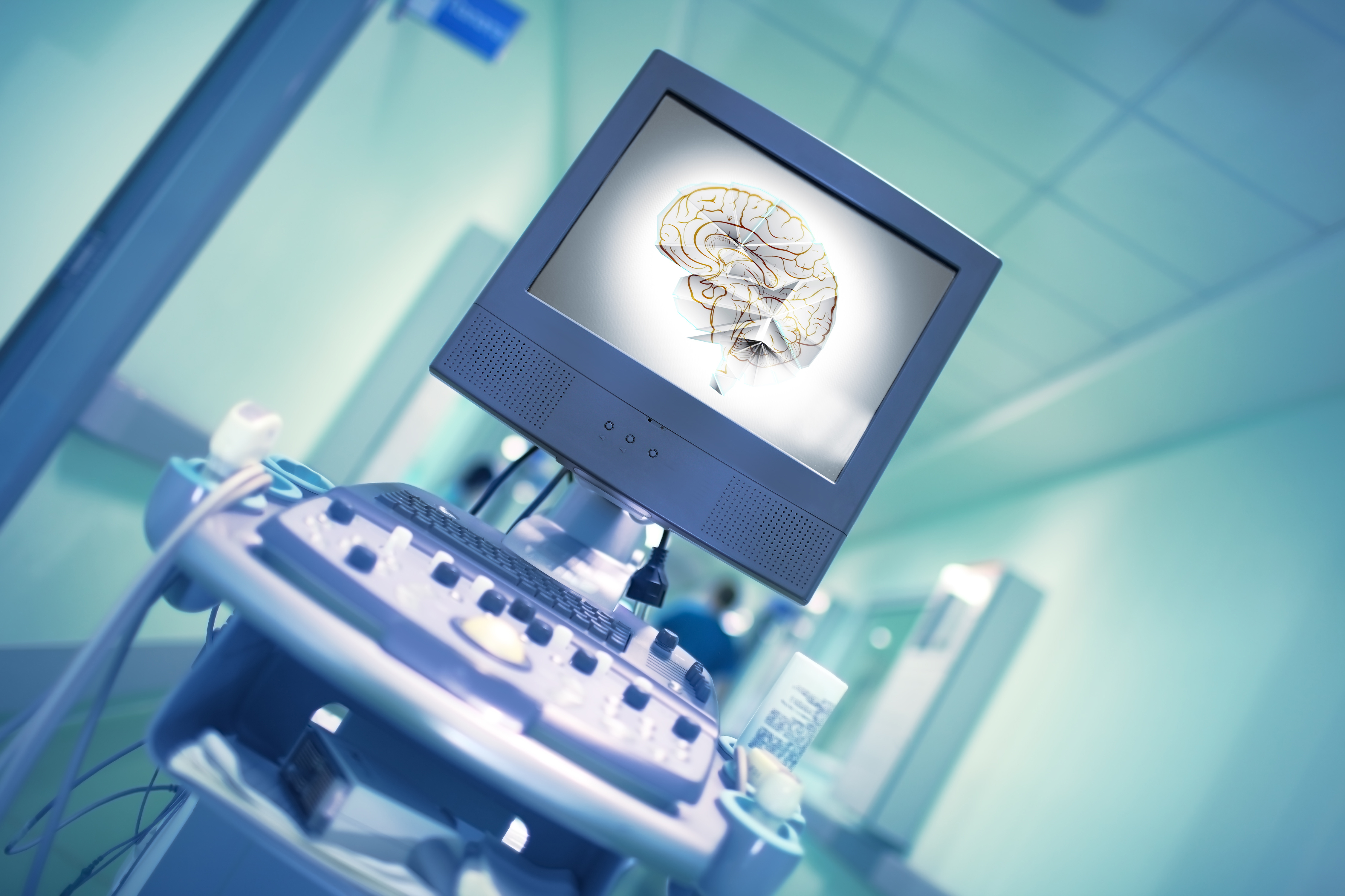 La stimulation transcrânienne par ultrasons pourrait être utilisée de manière ciblée et efficace pour modifier des types spécifiques d'activité dans le cerveau (Visuel Adobe Stock 199883889) La stimulation transcrânienne par ultrasons pourrait être utilisée de manière ciblée et efficace pour modifier des types spécifiques d'activité dans le cerveau (Visuel Adobe Stock 199883889)