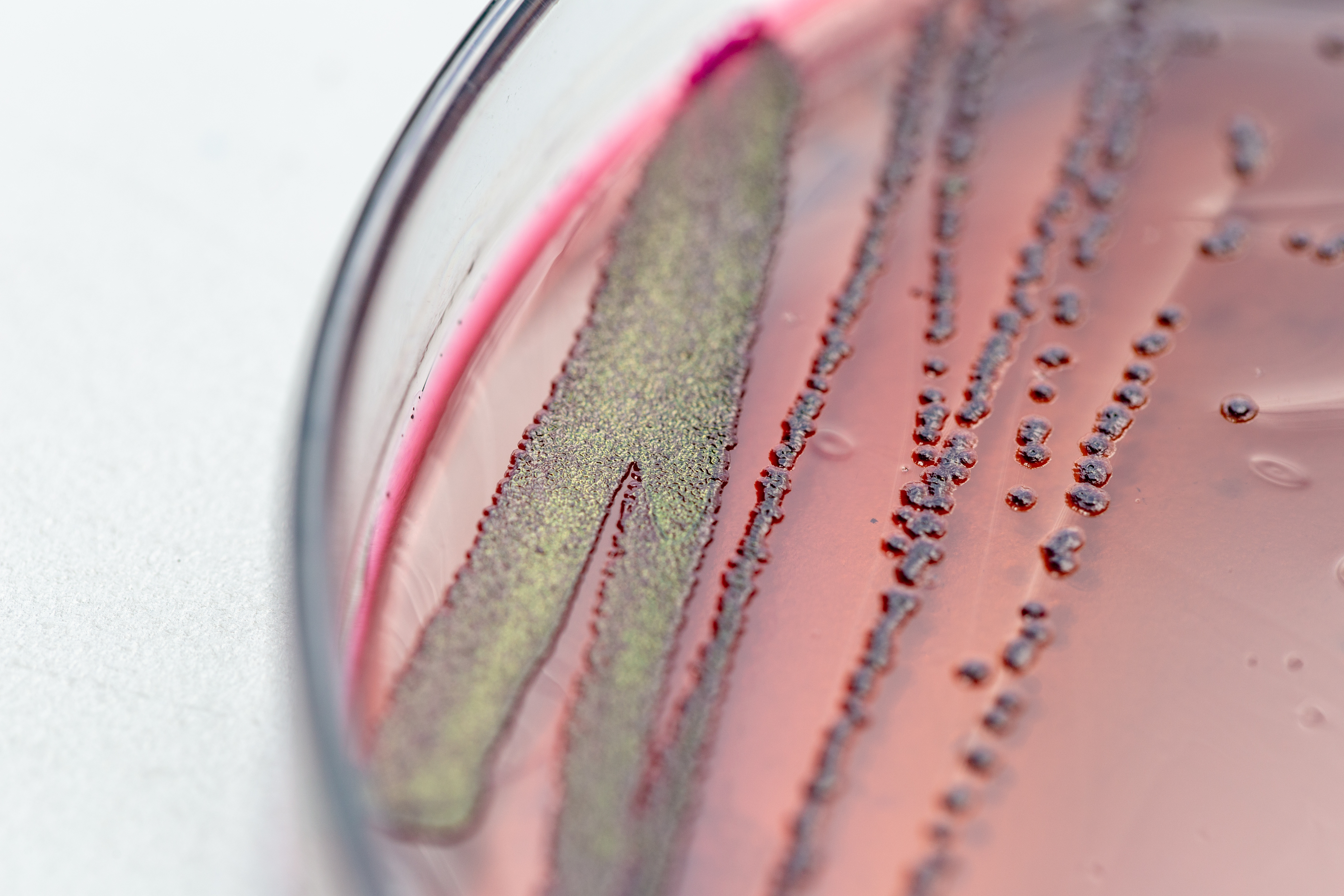 L'E. coli AIEC colonise la muqueuse intestinale (Adobe Stock 205547933)