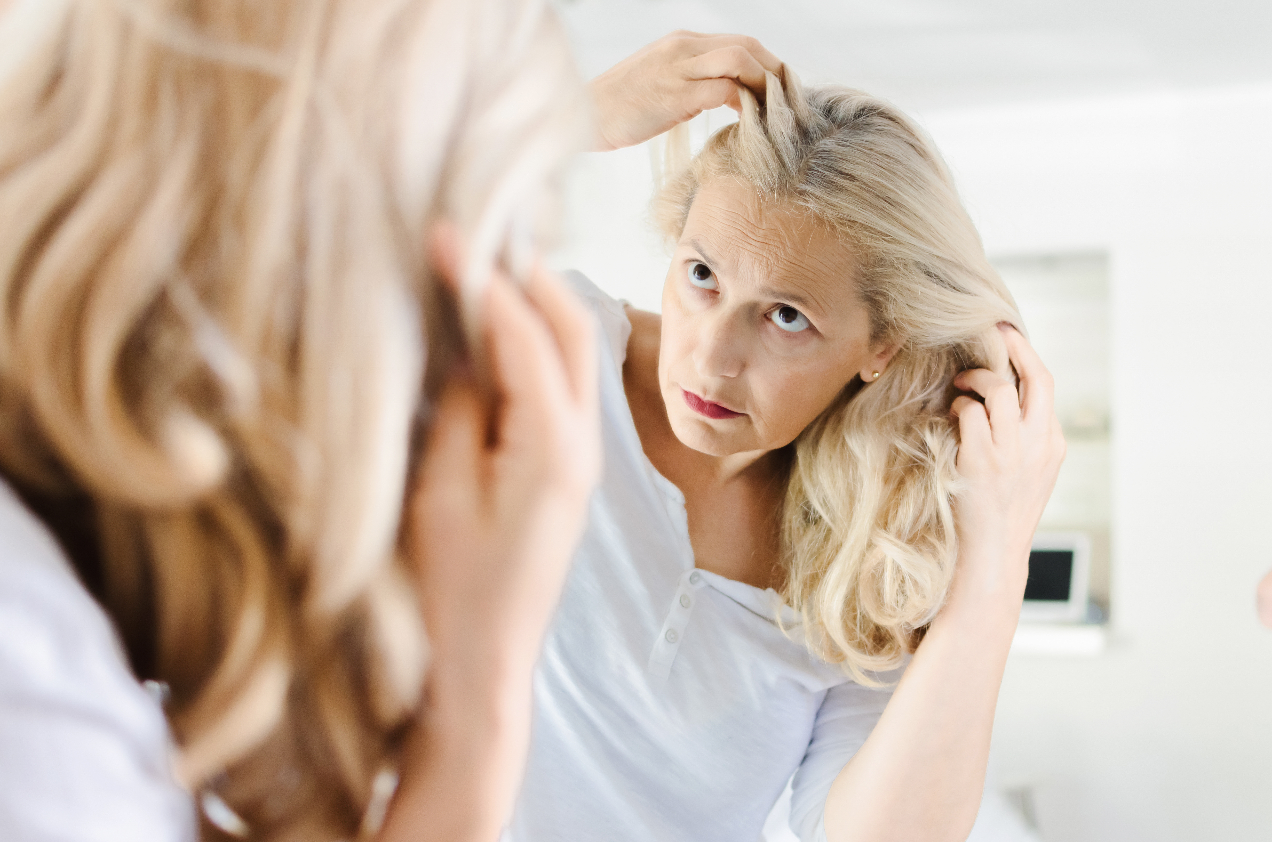 Chez la Femme aussi, de nouvelles thérapies offrent l'espoir de minimiser la perte et l'amincissement des cheveux (Visuel Adobe Stock 219975748)