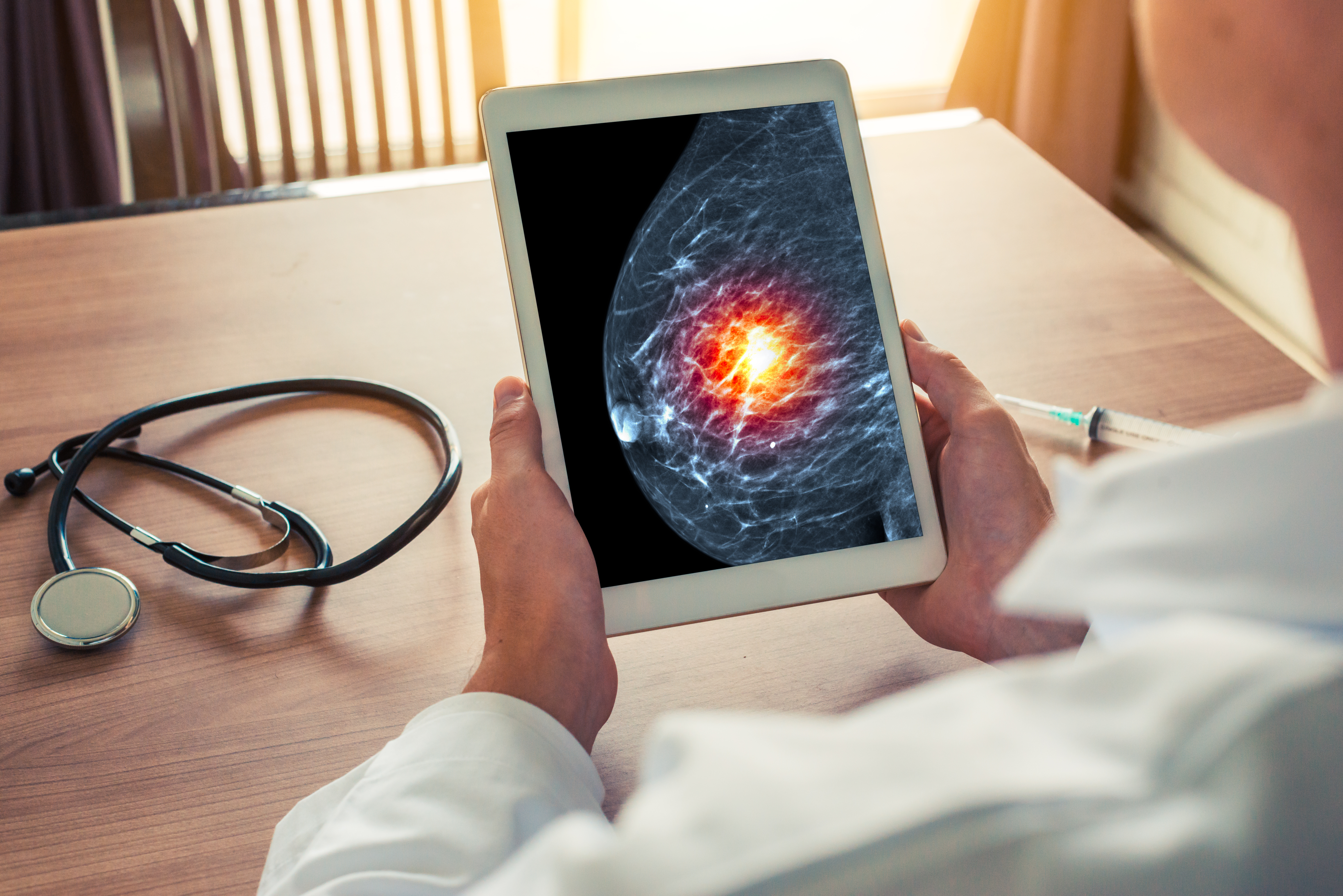 La crise sanitaire COVID-19 a entraîné une augmentation des décès par cancer du sein, sans aucun doute, juste la pointe de l’iceberg (Visuel Adobe Stock 221990325) La crise sanitaire COVID-19 a entraîné une augmentation des décès par cancer du sein, sans aucun doute, juste la pointe de l’iceberg (Visuel Adobe Stock 221990325)