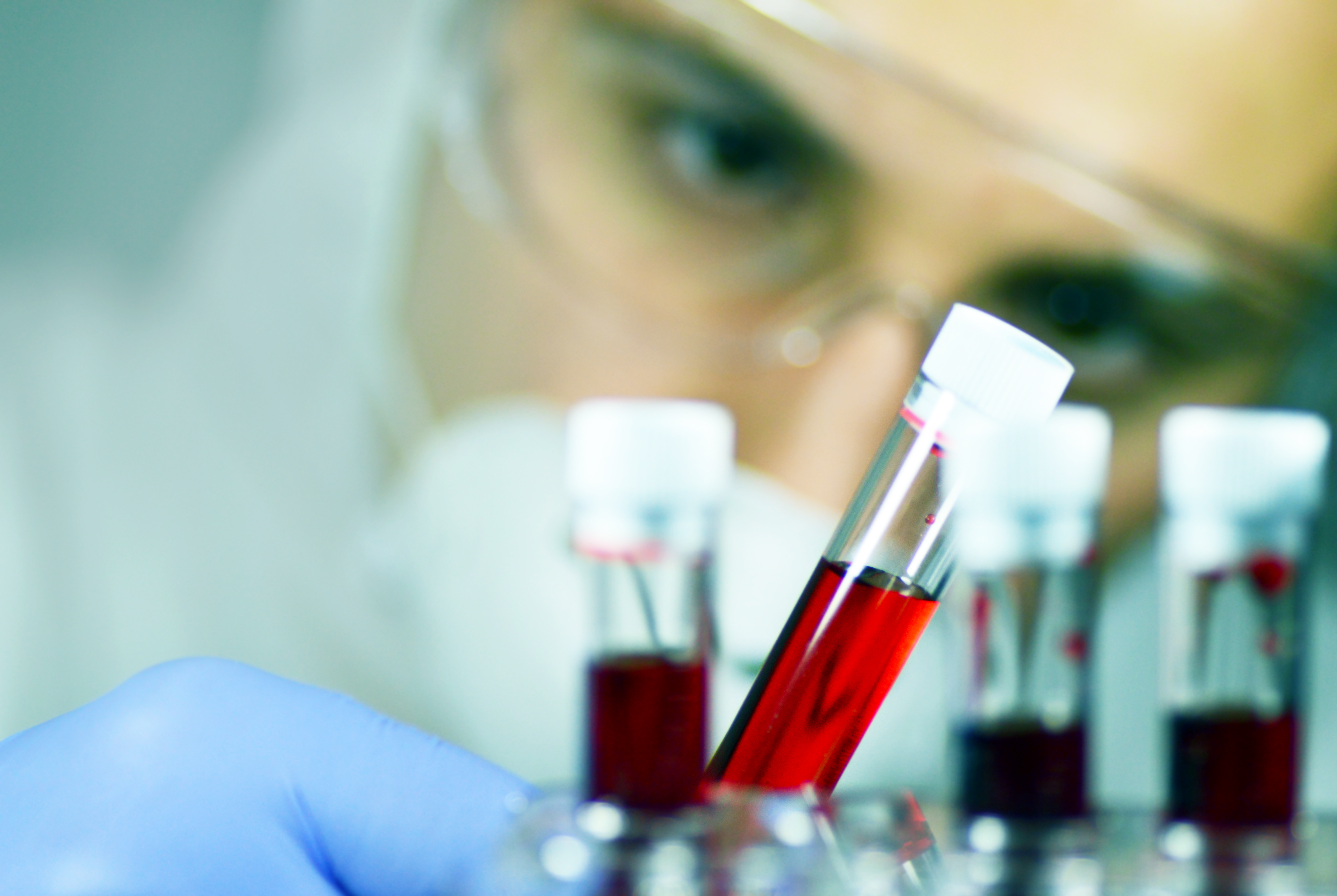 Des signatures de lymphocytes T peuvent contribuer à expliquer pourquoi certaines personnes développent un COVID-19 sévère et meurent tandis que d'autres personnes se rétablissent facilement (Visuel Adobe Stock 230517428) Des signatures de lymphocytes T peuvent contribuer à expliquer pourquoi certaines personnes développent un COVID-19 sévère et meurent tandis que d'autres personnes se rétablissent facilement (Visuel Adobe Stock 230517428)