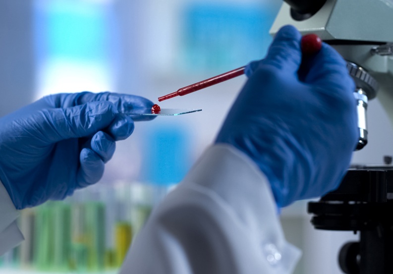 Un test sanguin de détection précoce multicancer apporte ici sa première preuve de concept en identifiant des signaux tumoraux correspondant à 17 grandes catégories de cancers (Visuel Adobe Stock 233950564)