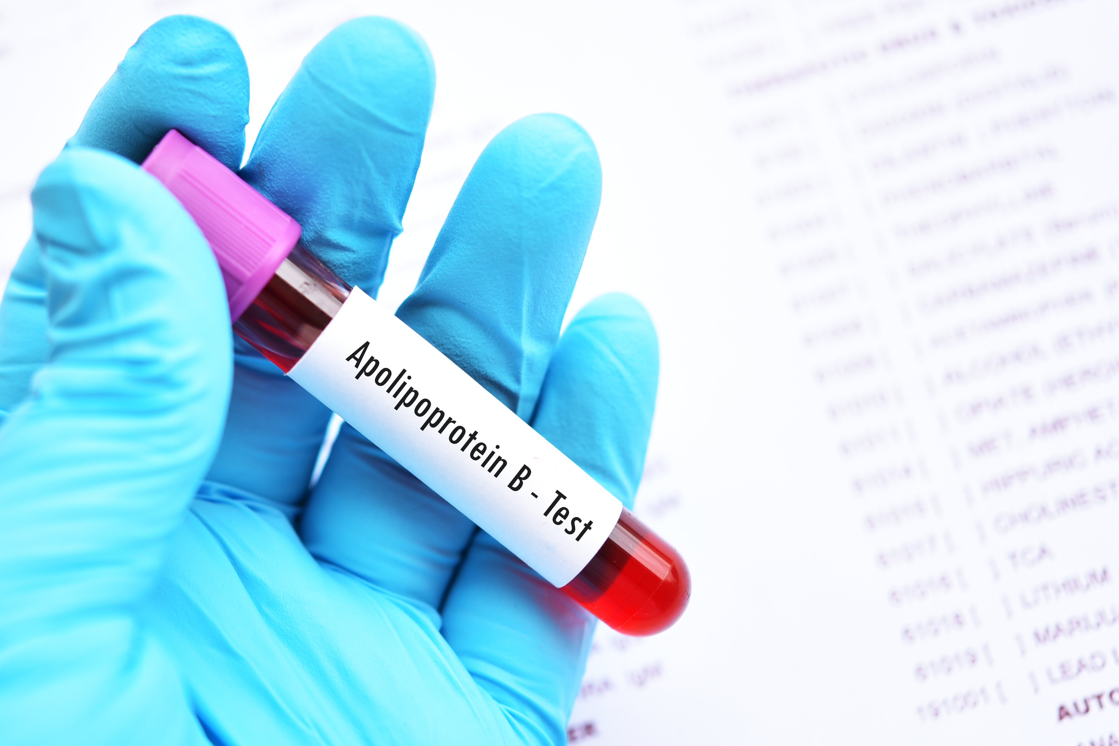 Un test de cholestérol peu utilisé pourrait prévenir davantage d'infarctus et d'AVC (Visuel Adobe Stock 236290541)