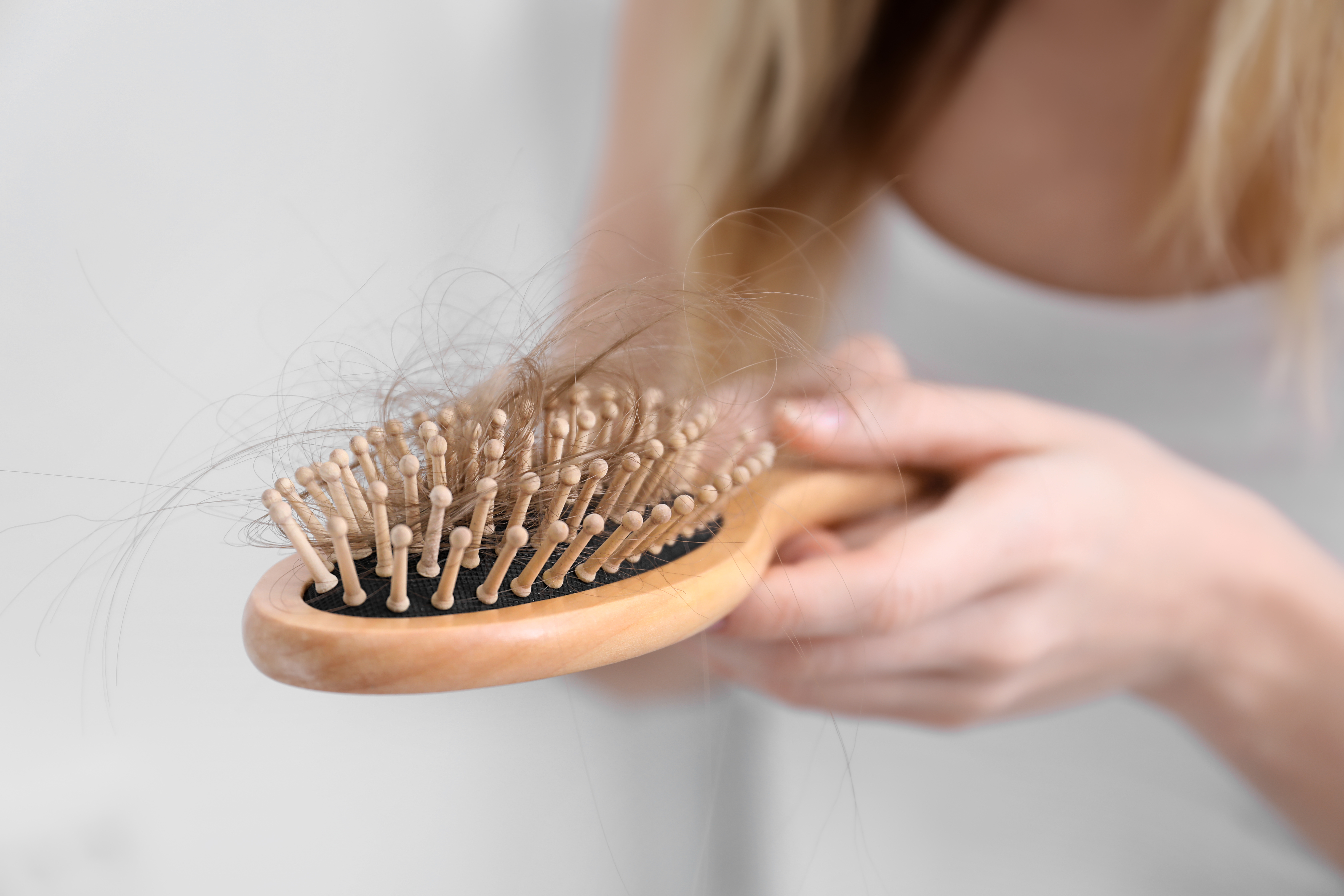 Chez les femmes, ce risque de perte de cheveux apparaît en effet associé à la baisse des niveaux d'œstrogène pendant la période de transition vers la ménopause, mais pas seulement (Visuel Adobe Stock 240839013). 
