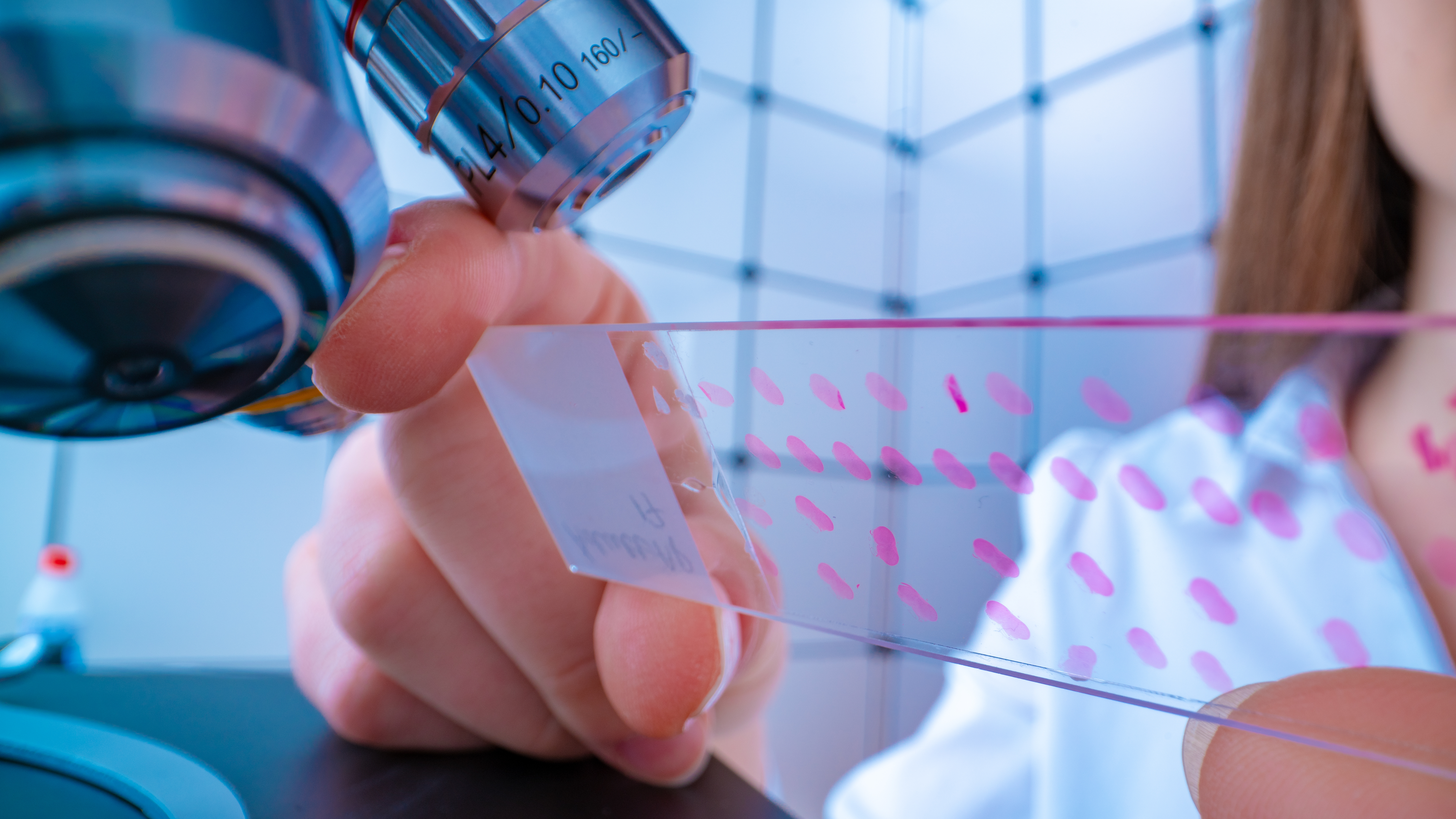 Une simple biopsie cutanée peut évaluer les dommages tissulaires plus profonds, liés au COVID-19 (Visuel Adobe Stock 242337985) Une simple biopsie cutanée peut évaluer les dommages tissulaires plus profonds, liés au COVID-19 (Visuel Adobe Stock 242337985)