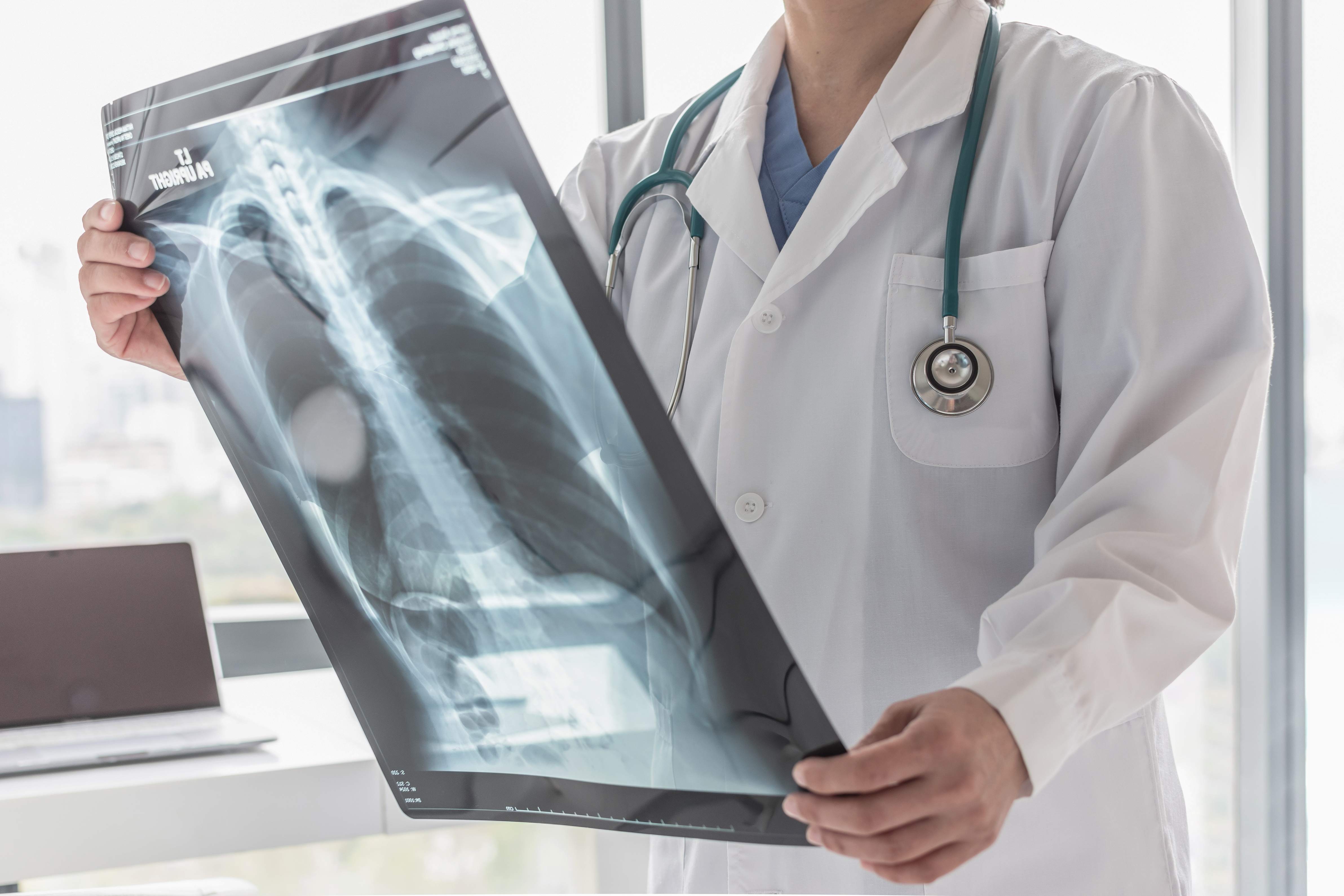 C'est la confirmation de l‘efficacité d’une nouvelle thérapie médicamenteuse combinée, qui traite les défauts moléculaires sous-jacents de la maladie, chez les enfants d'âge scolaire primaire (Visuel Adobe Stock 254908648) C'est la confirmation de l‘efficacité d’une nouvelle thérapie médicamenteuse combinée, qui traite les défauts moléculaires sous-jacents de la maladie, chez les enfants d'âge scolaire primaire (Visuel Adobe Stock 254908648)