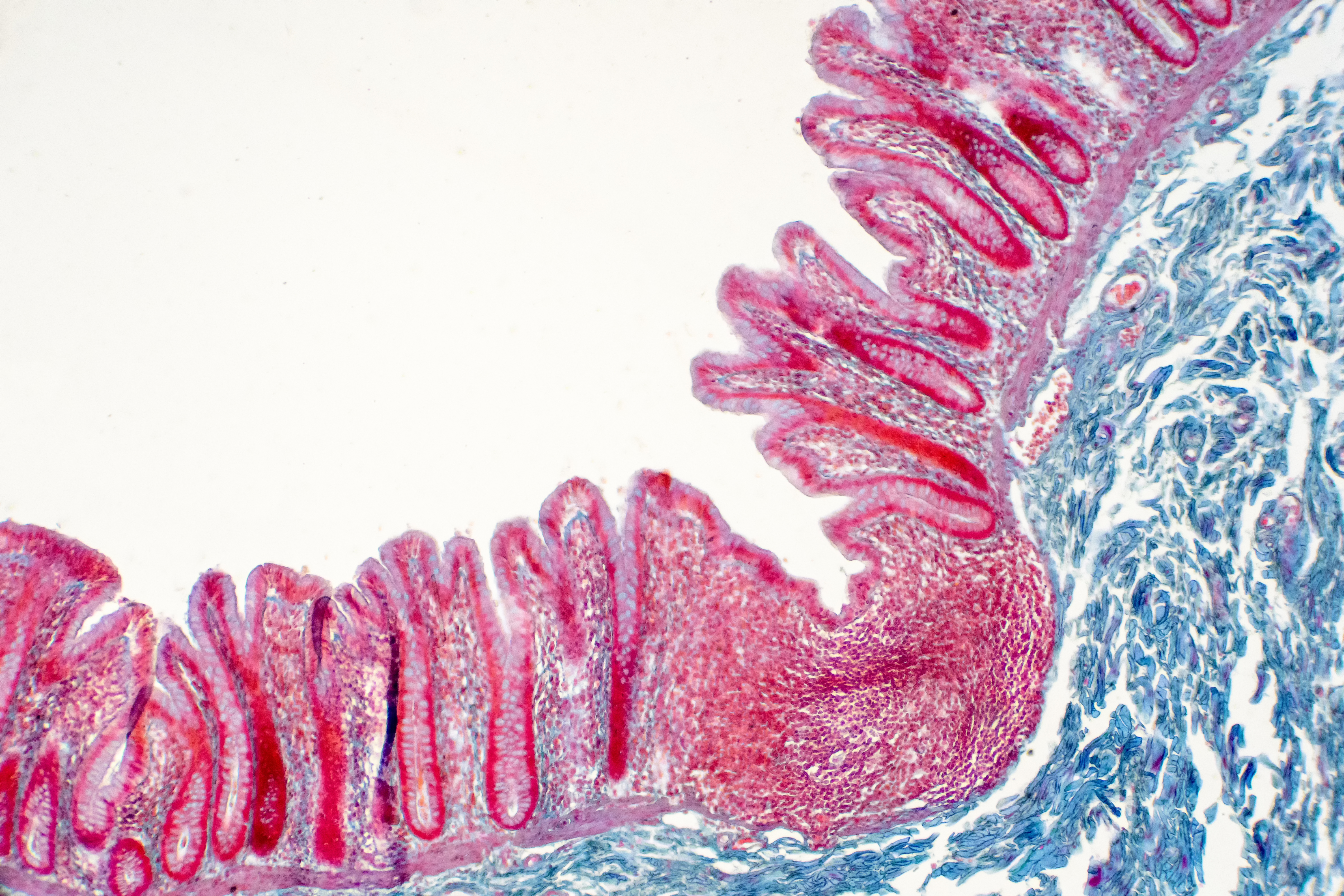 Le tofacitinib répare les défauts de perméabilité intestinale induits par l'inflammation