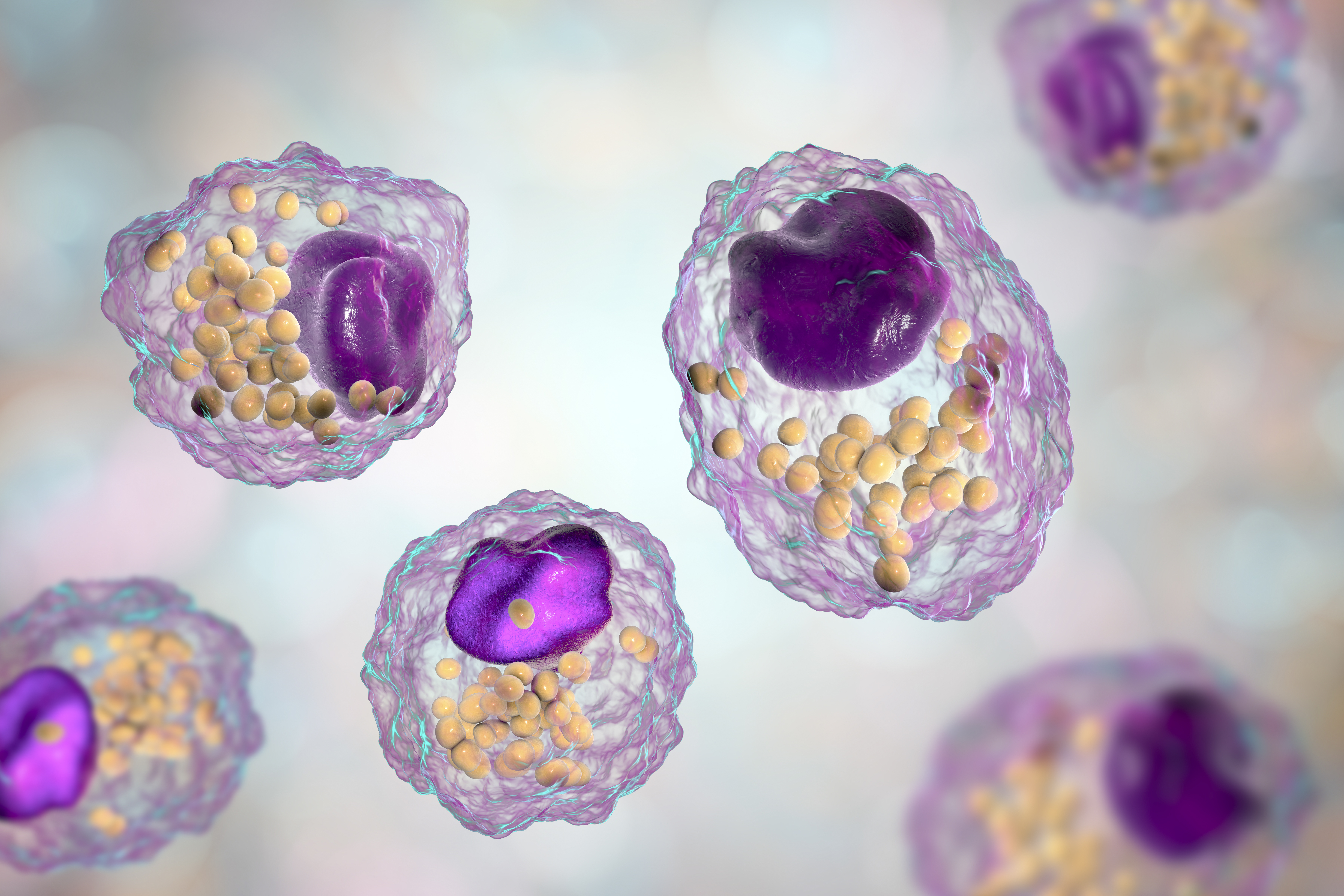 Quand la digestion des macrophages tourne mal, et en ce qui concerne le nettoyage de nos poumons, l’élimination des surfactants des alvéoles de nos poumons est ralentie, les sécrétions s’accumulent, la respiration s’altère et c’est le début de l’infection pulmonaire (Visuel Adobe Stock 266377735)