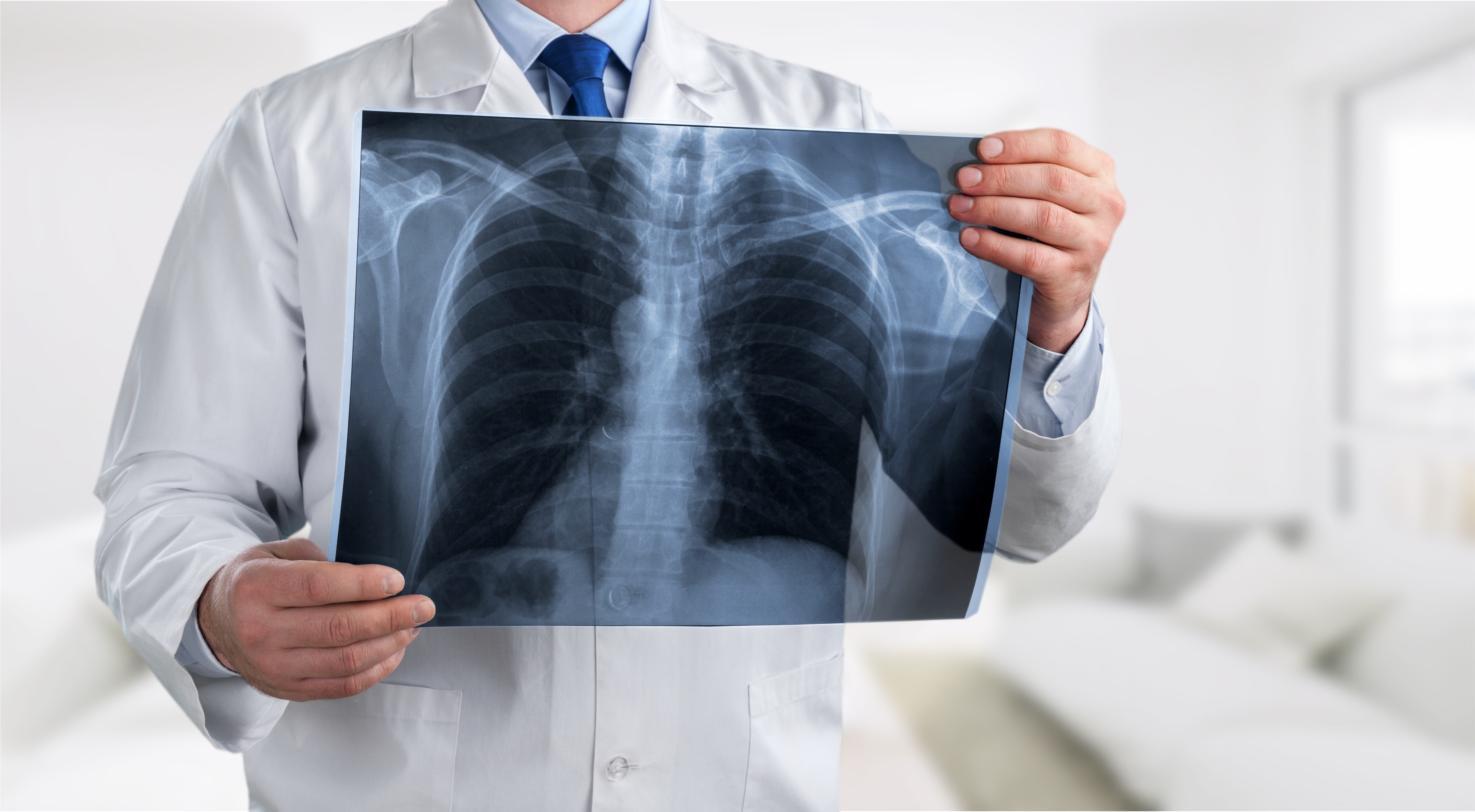 La supplémentation alimentaire en nitrate pourrait induire une augmentation de la fonction contractile du diaphragme (Visuel Adobe Stock 276455512) La supplémentation alimentaire en nitrate pourrait induire une augmentation de la fonction contractile du diaphragme (Visuel Adobe Stock 276455512)