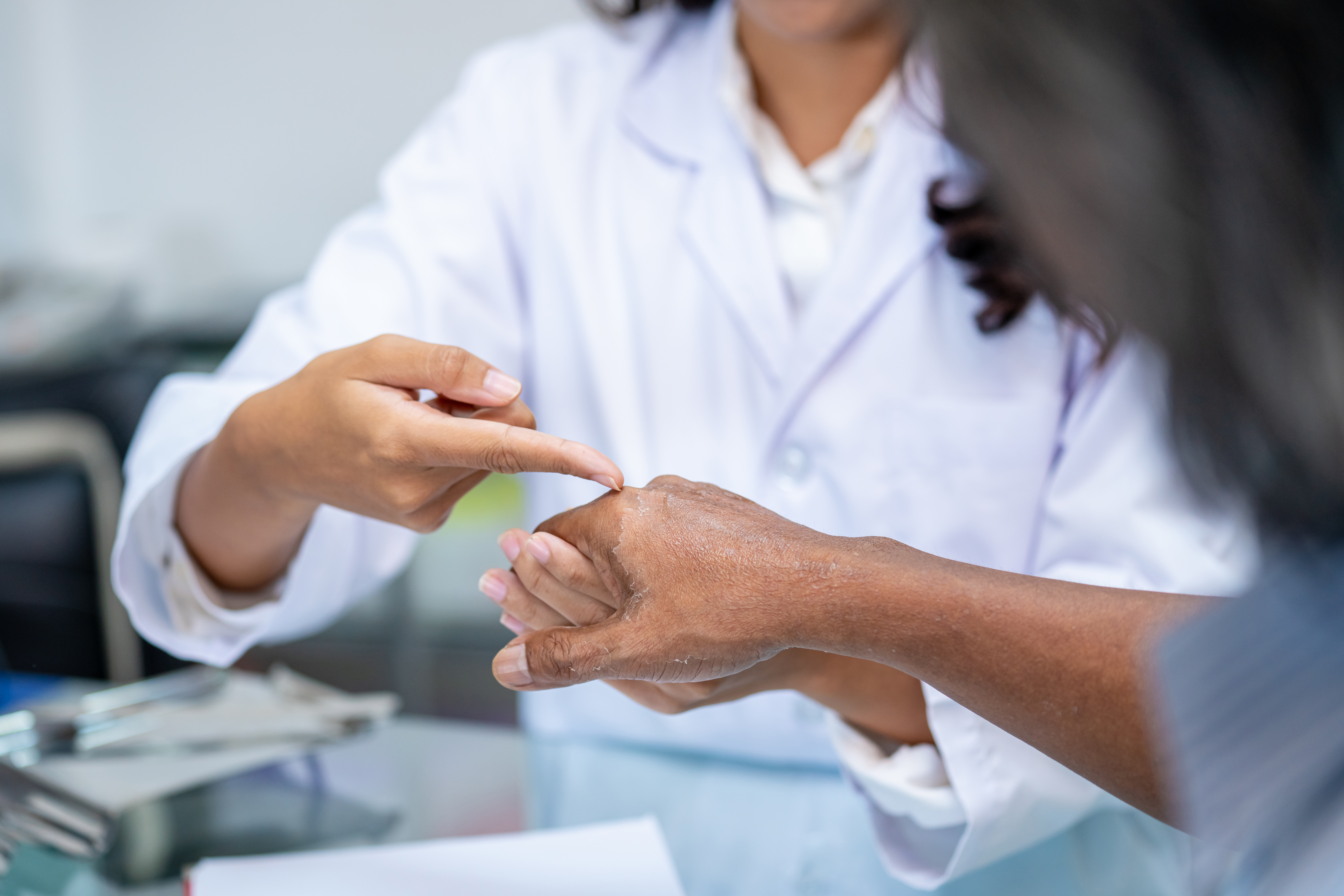 L'estradiol pourrait jouer un rôle protecteur dans l'inflammation psoriasique (Visuel Adobe Stock 277686967) L'estradiol pourrait jouer un rôle protecteur dans l'inflammation psoriasique (Visuel Adobe Stock 277686967)