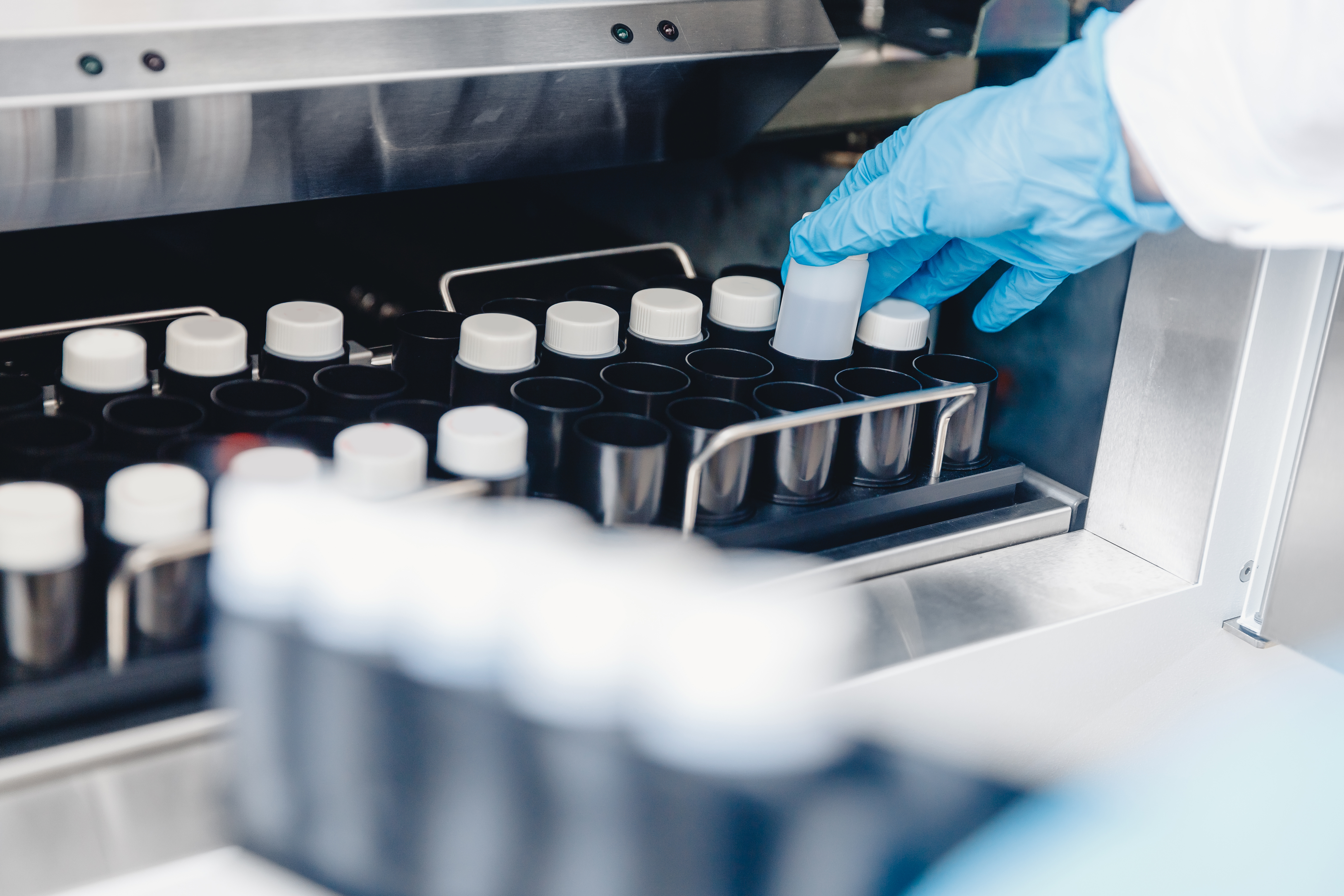 L'infection des testicules par SARS-CoV-2 semble possible, avec des conséquences sur la fertilité (Visuel adobe Stock 292084395) L'infection des testicules par SARS-CoV-2 semble possible, avec des conséquences sur la fertilité (Visuel adobe Stock 292084395)