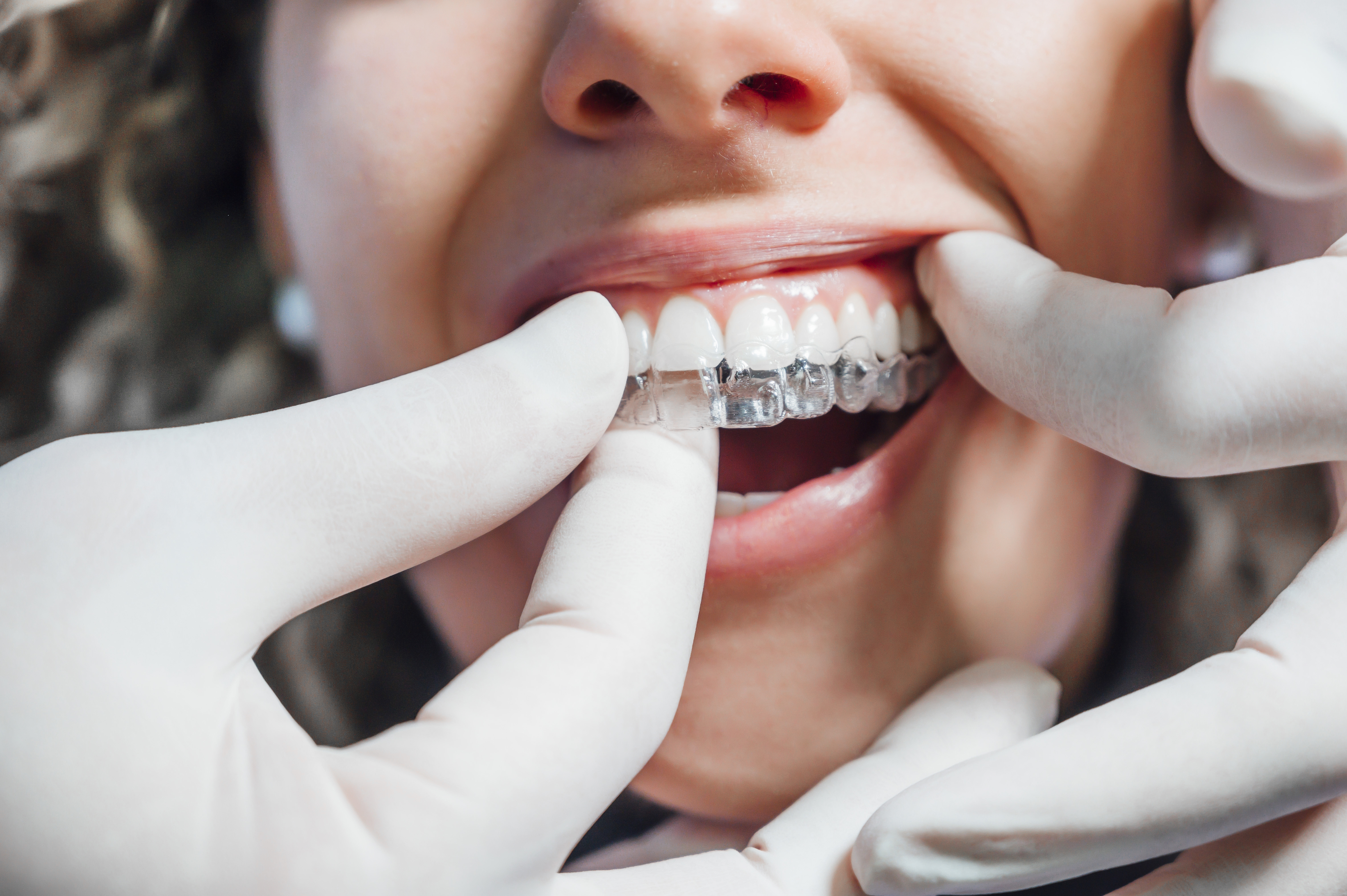 Une fois au cabinet dentaire, tous les patients partagent un même souhait, celui de pouvoir arborer un beau sourire confiant  (Adobe stock 311925482)