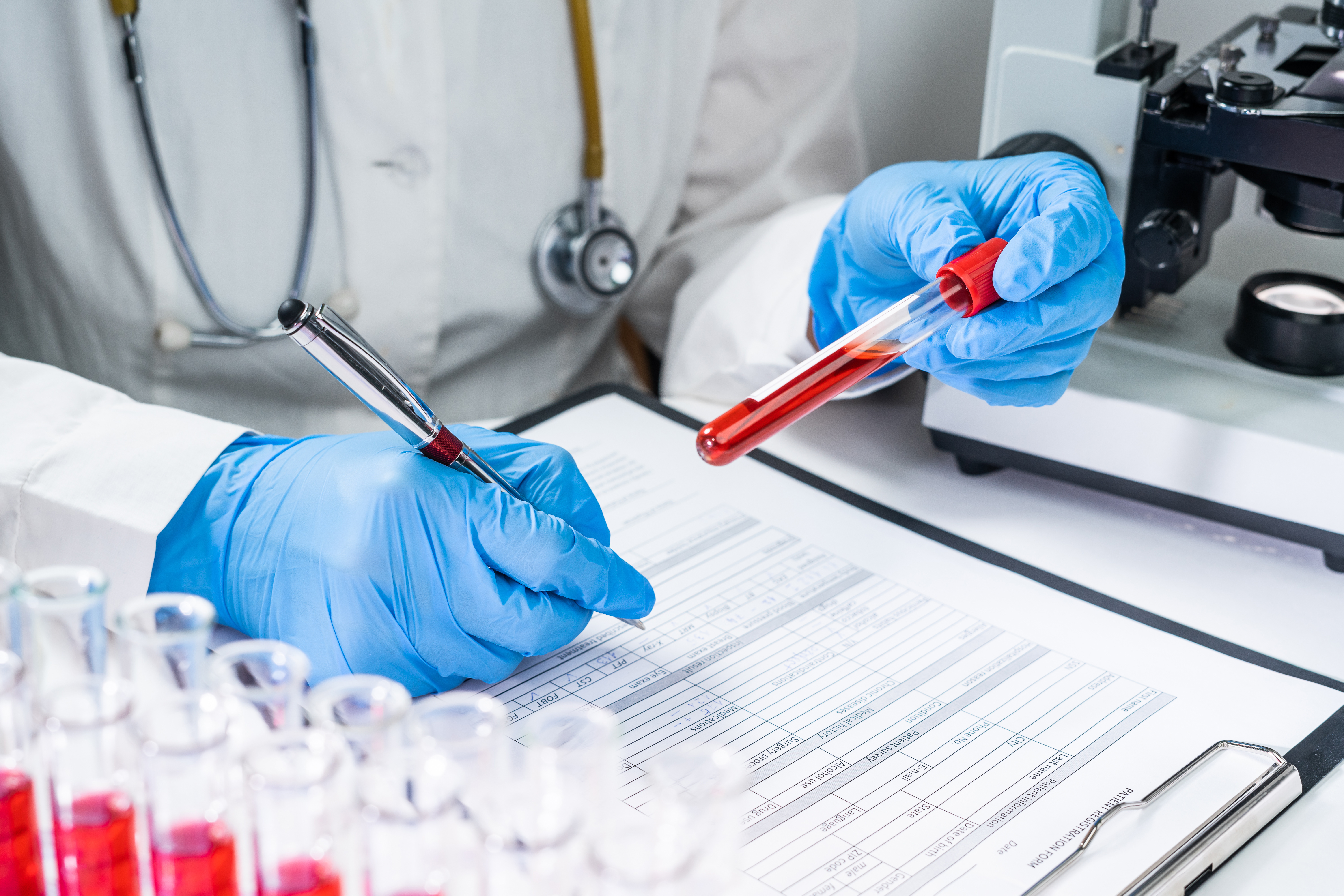Ce test sanguin permet de prédire les patients les plus susceptibles de bénéficier du dépistage du cancer du poumon (Visuel Adobe Stock 319612966) Ce test sanguin permet de prédire les patients les plus susceptibles de bénéficier du dépistage du cancer du poumon (Visuel Adobe Stock 319612966)