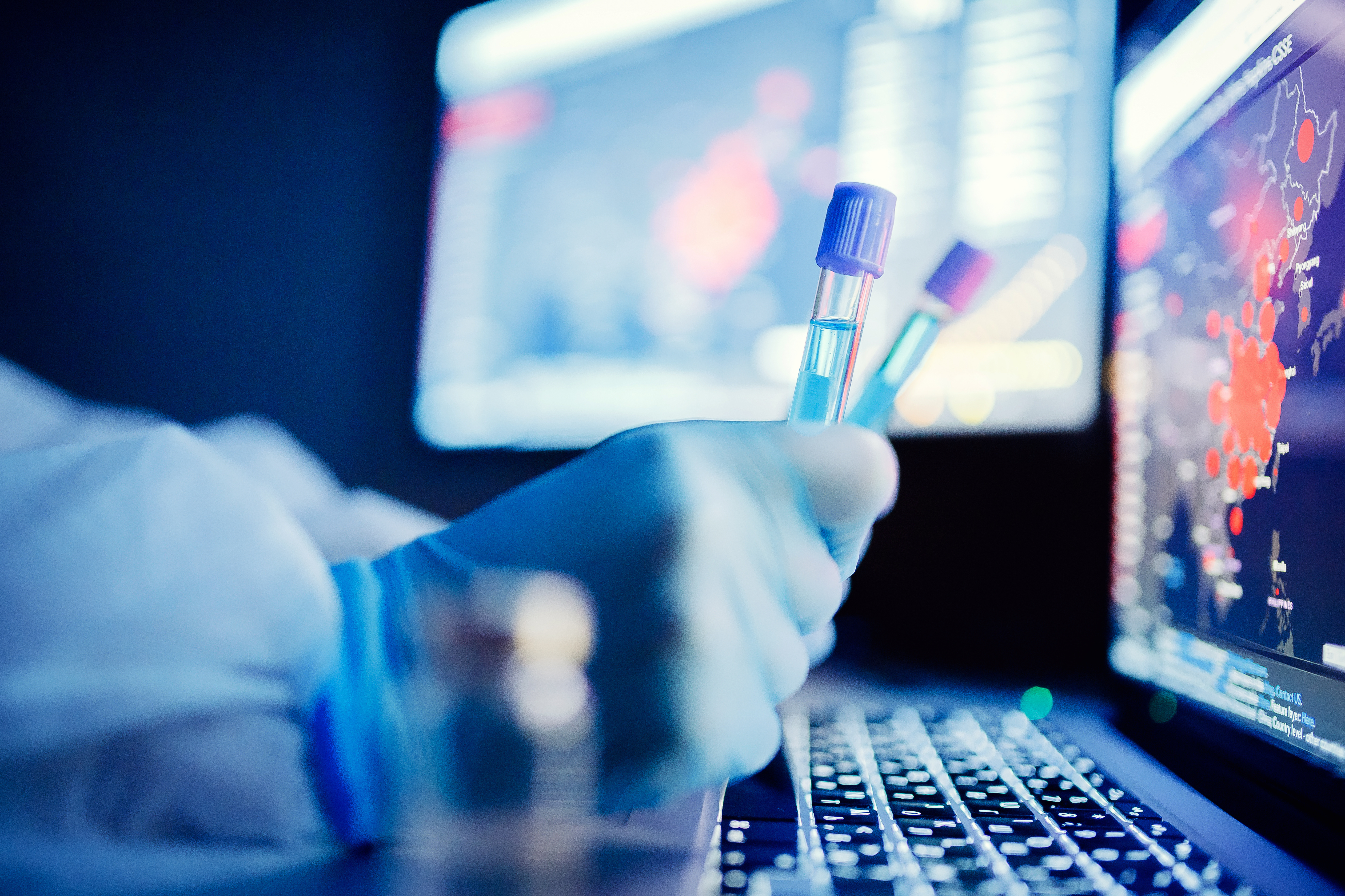 Quels sont les vaccins sûrs et efficaces pour le rappel (ou 3è injection) après les 2 doses de vaccin à ARNm (Pfizer/BioNTech et Moderna) ? (Visuel Adobe Stock 321710772) Quels sont les vaccins sûrs et efficaces pour le rappel (ou 3è injection) après les 2 doses de vaccin à ARNm (Pfizer/BioNTech et Moderna) ? (Visuel Adobe Stock 321710772)