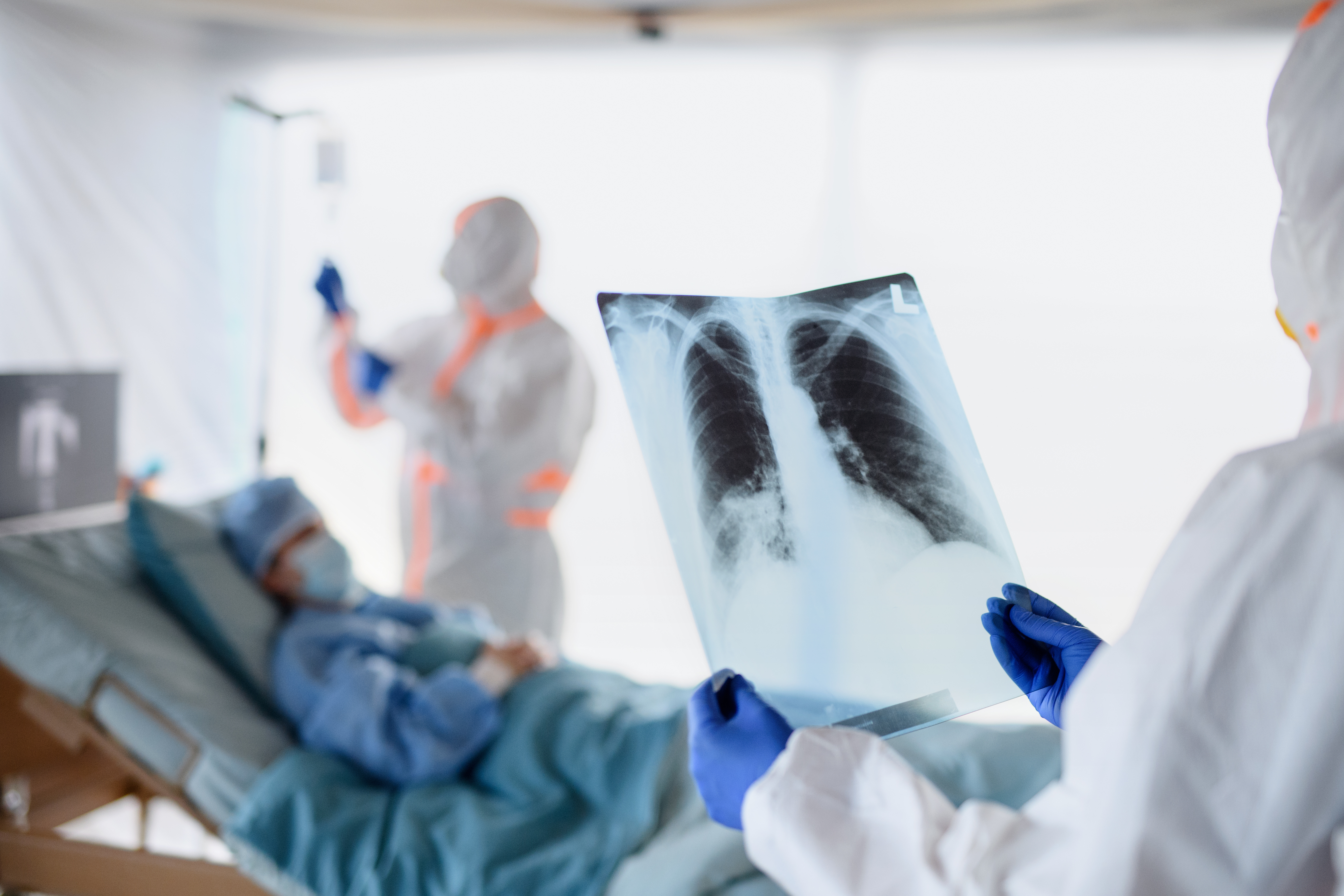Un tiers des patients hospitalisés pour une forme grave de COVID-19 présentent toujours des anomalies pulmonaires un an plus tard (Visuel Adobe Stock 331045992) Un tiers des patients hospitalisés pour une forme grave de COVID-19 présentent toujours des anomalies pulmonaires un an plus tard (Visuel Adobe Stock 331045992)