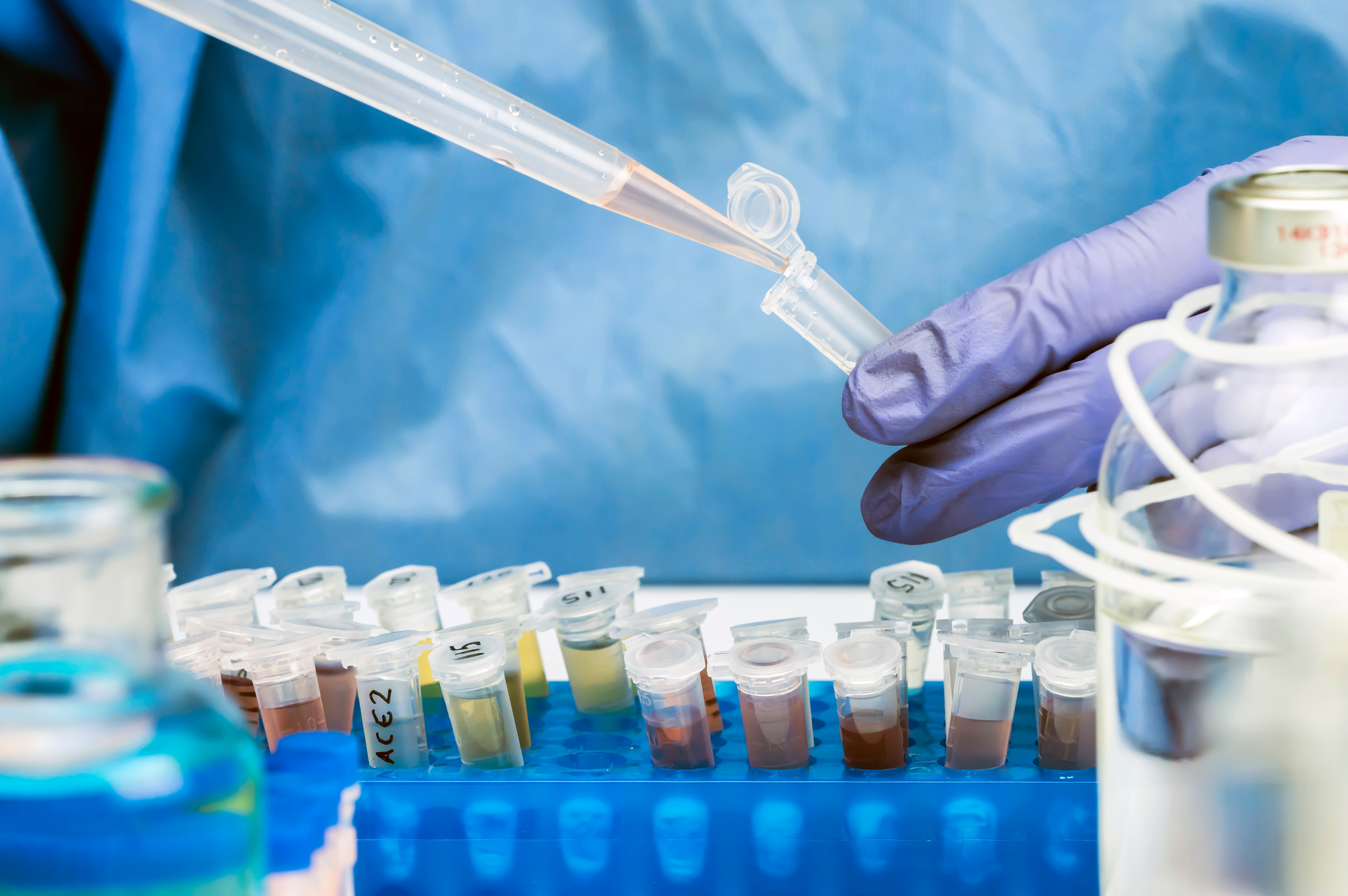Pourquoi ne pas avoir recours à l'analyse des eaux usées pour suivre la propagation du monkeypox ou variole du singe ? (Visuel Adobe Stock 345737530) Pourquoi ne pas avoir recours à l'analyse des eaux usées pour suivre la propagation du monkeypox ou variole du singe ? (Visuel Adobe Stock 345737530)