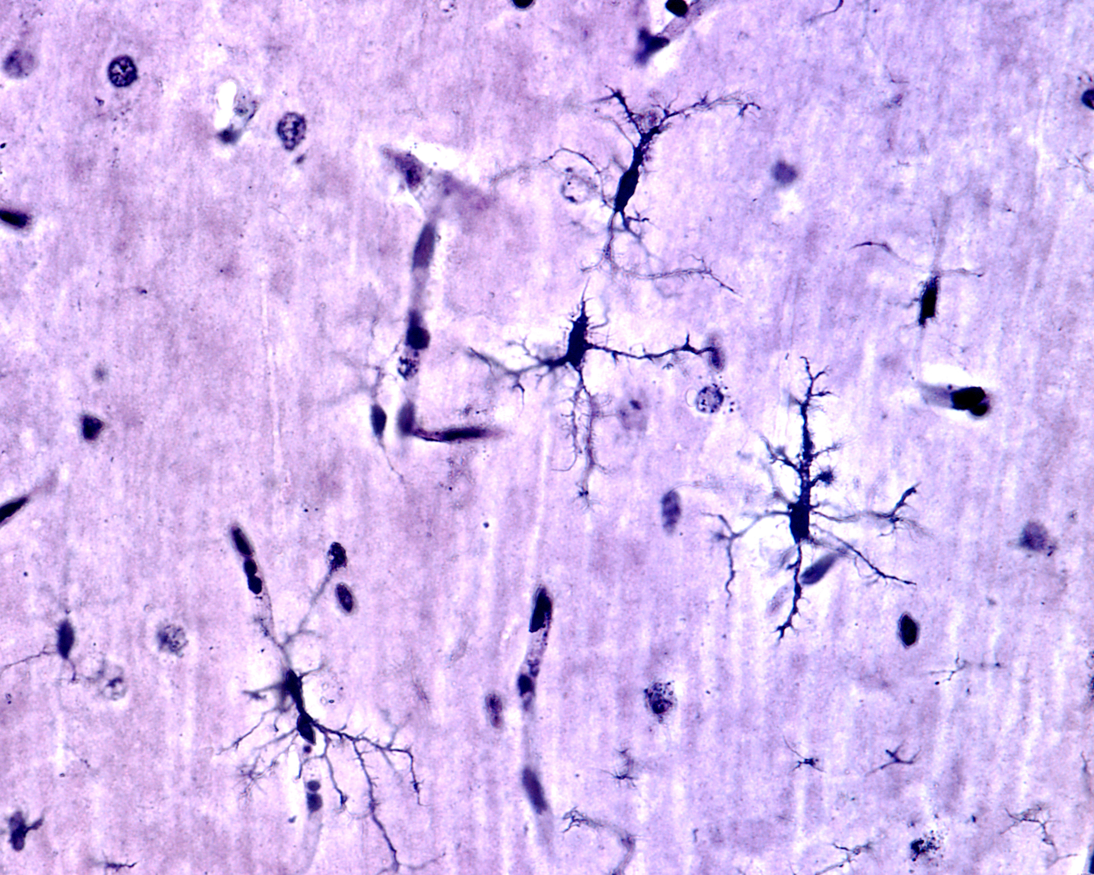 Une nouvelle piste de traitement de l'épilepsie est inspirée par la réponse immunitaire naturelle du cerveau (Visuel adobe Stock 398867897)