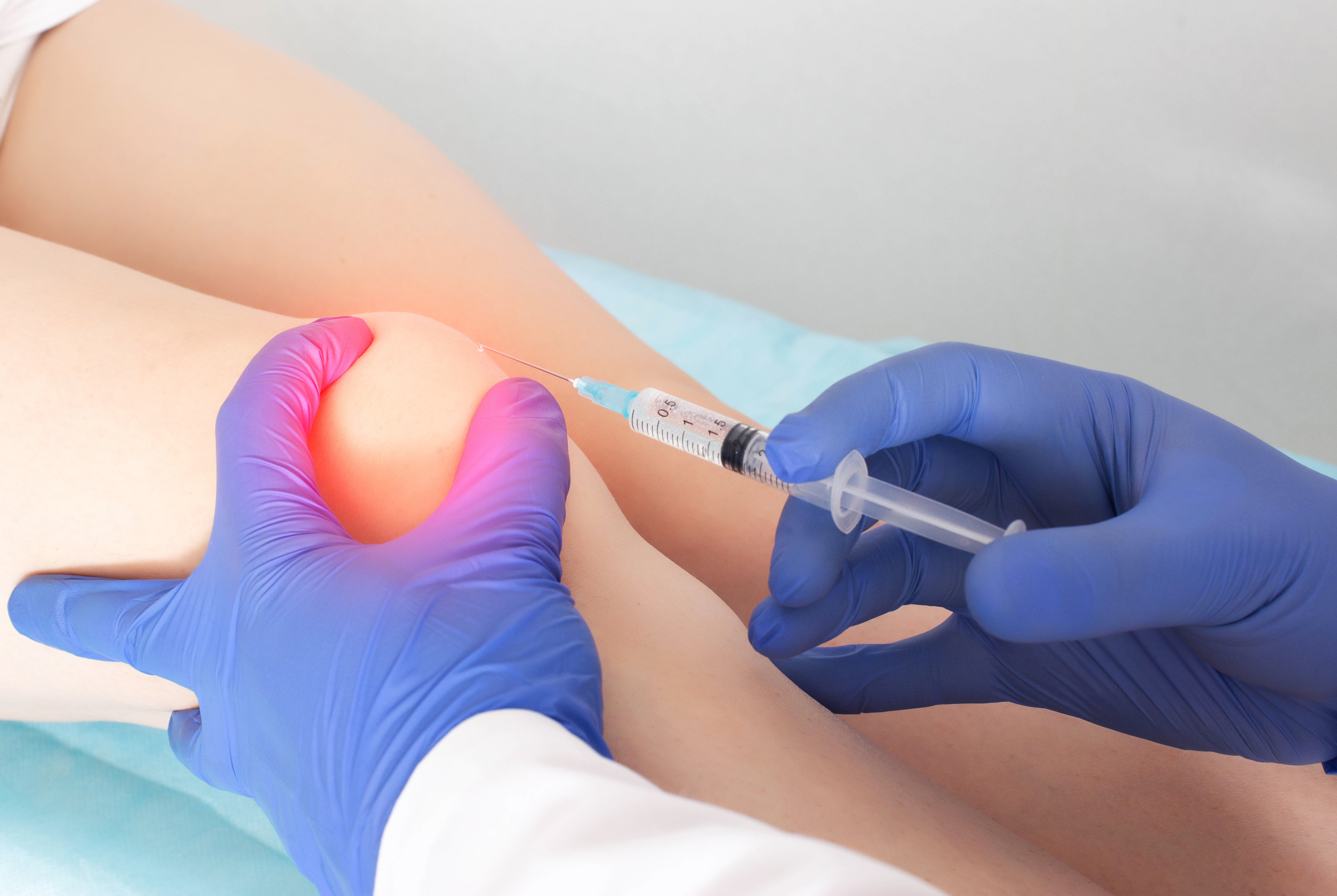 L'activation de cette protéine, RORβ pourrait donc être une stratégie prometteuse pour prévenir ou retarder le développement de l'arthrose (Visuel Adobe Stock 410060481) L'activation de cette protéine, RORβ pourrait donc être une stratégie prometteuse pour prévenir ou retarder le développement de l'arthrose (Visuel Adobe Stock 410060481).
