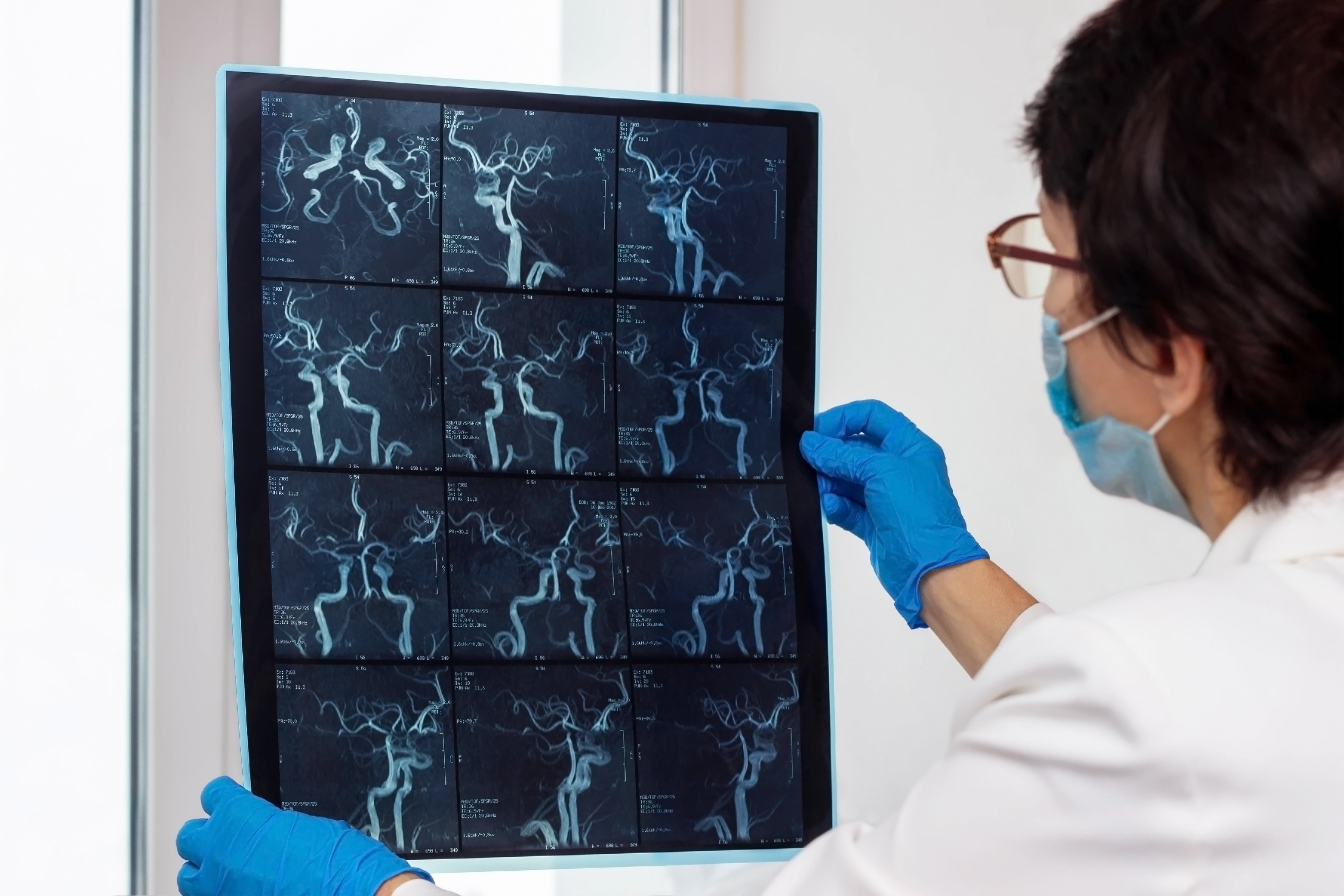 Les personnes atteintes d'une maladie cardiovasculaire précoce peuvent être plus susceptibles d'avoir une moins bonne santé cérébrale à l'âge mûr (Visuel Adobe Stock 414489212)