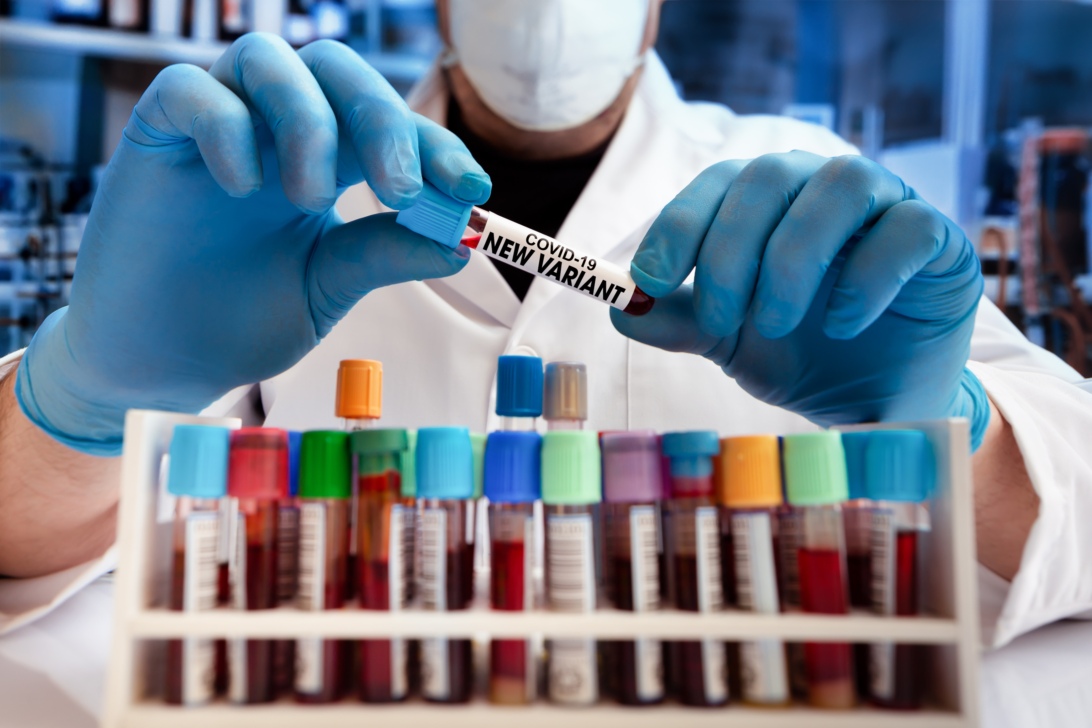 Un variant « hautement muté » qui émerge chez un patient vivant avec un VIH avancé et infecté par le coronavirus (Visuel Adobe Stock 42391758) Un variant « hautement muté » qui émerge chez un patient vivant avec un VIH avancé et infecté par le coronavirus (Visuel Adobe Stock 42391758)