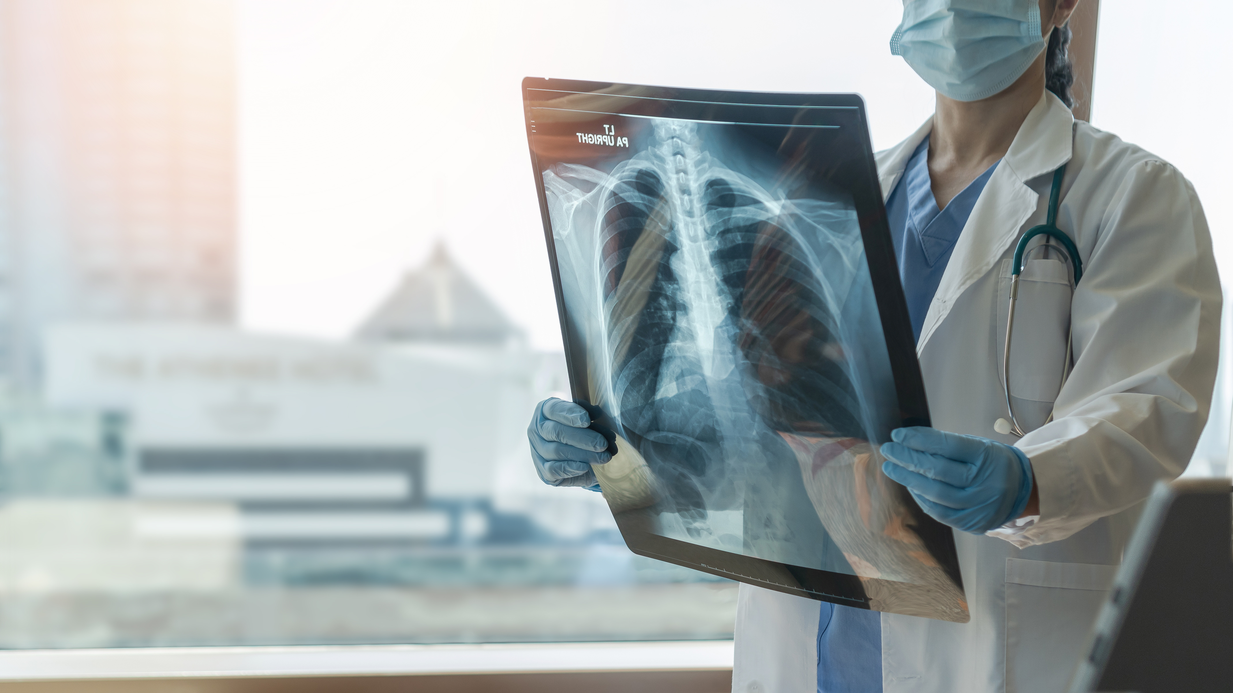 Ces travaux ouvrent l’espoir de parvenir à bloquer l’action délétère de 2 molécules, proline et glucose, dans le développement de la HTAP (Adobe Stock 425734064) Ces travaux ouvrent l’espoir de parvenir à bloquer l’action délétère de 2 molécules, proline et glucose, dans le développement de la HTAP (Adobe Stock 425734064)