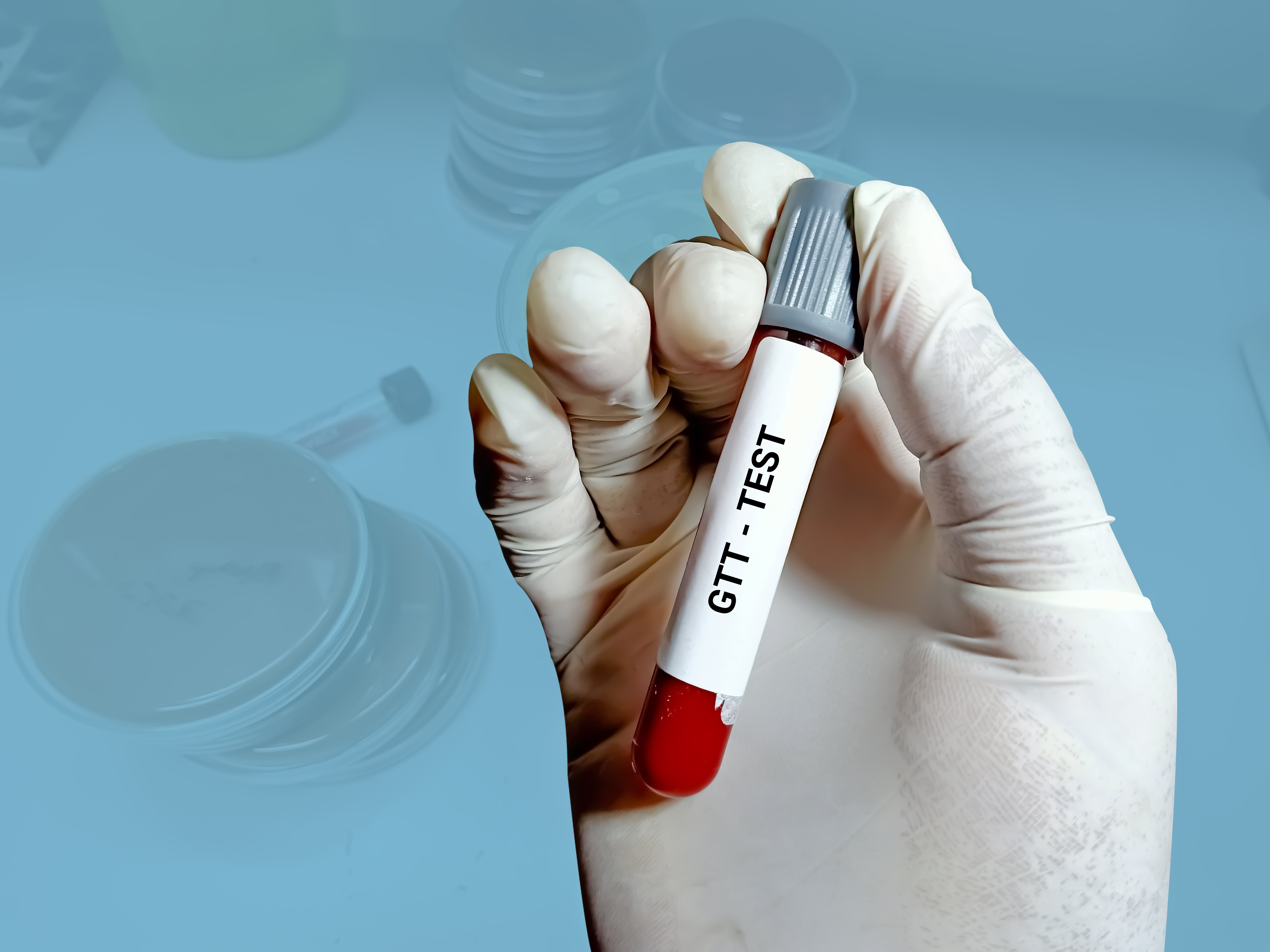 Les patients cancéreux qui développent un diabète ont un risque de mortalité prématurée plus précoce (Visuel Adobe Stock 440536164) Les patients cancéreux qui développent un diabète ont un risque de mortalité prématurée plus précoce (Visuel Adobe Stock 440536164)