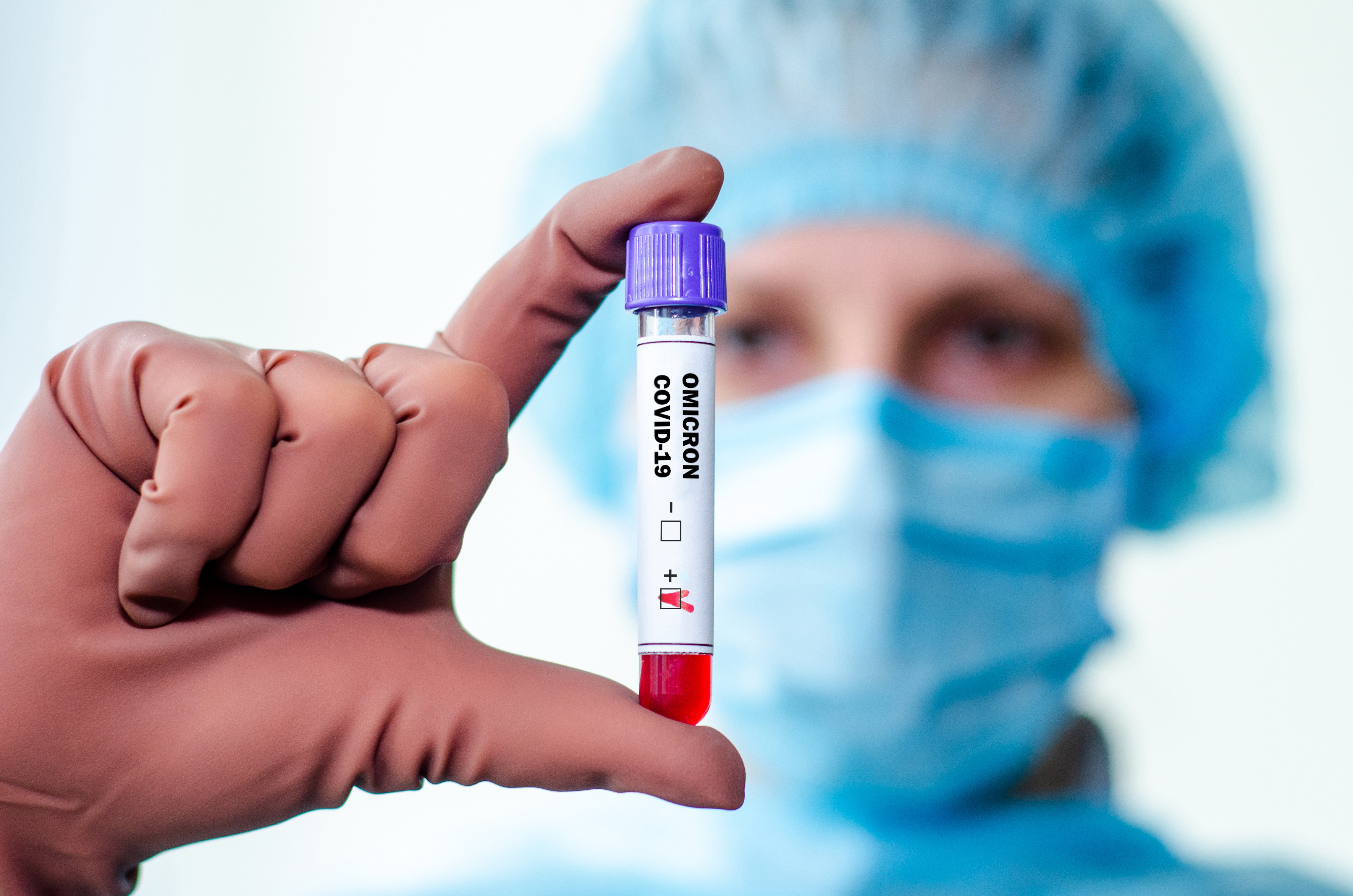 Non, Omicron n’est pas infectieux moins longtemps que les précédents variants (Visuel Adobe Stock 472002477) Non, Omicron n’est pas infectieux moins longtemps que les précédents variants (Visuel Adobe Stock 472002477)