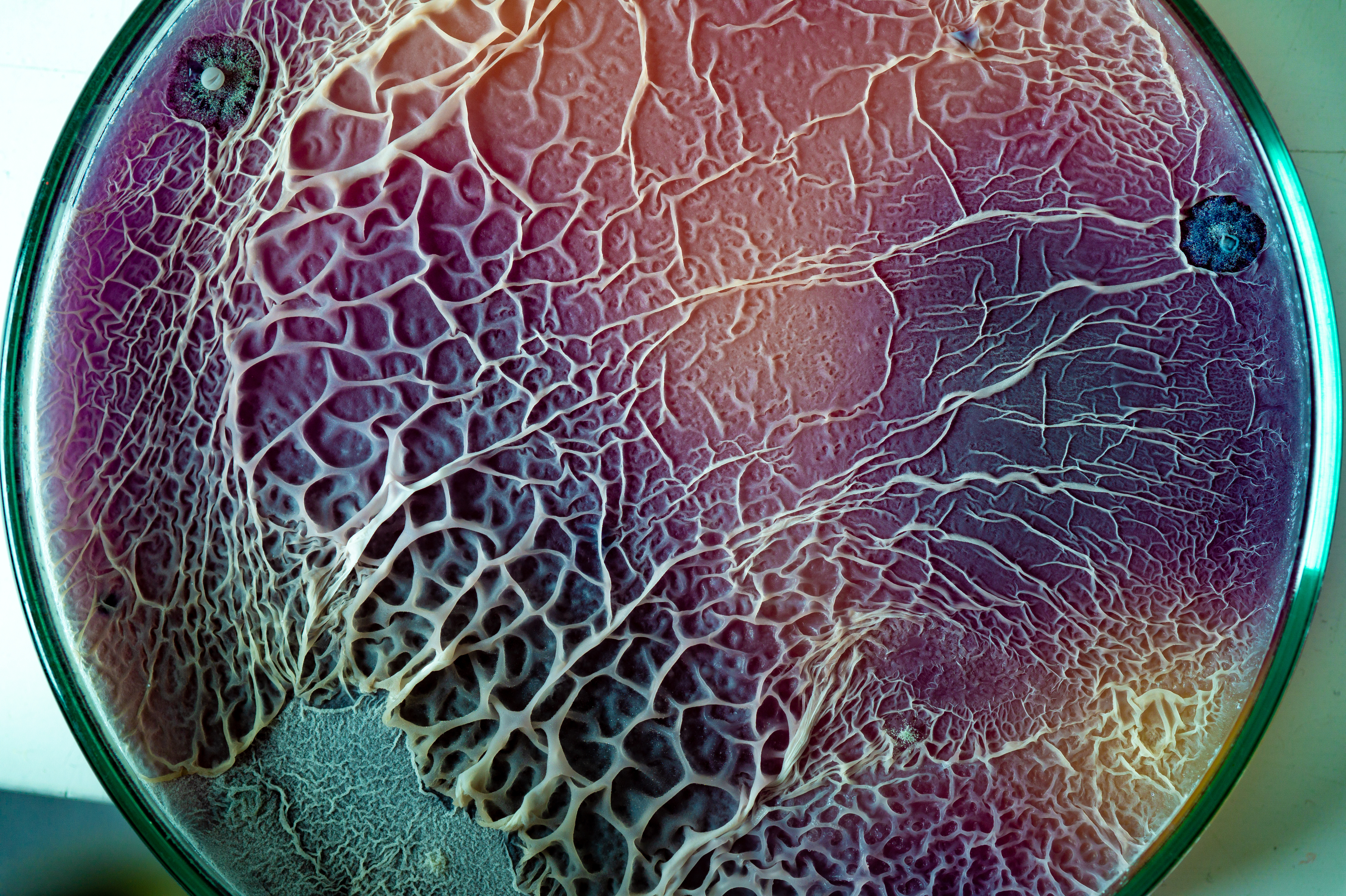 La combinaison de bétadine et de gel colloïdal d'argent est le cocktail le plus efficace pour éliminer les bactéries responsables des infections de plaies et la formation de biofilms (Visuel Adobe Stock 473134741) La combinaison de bétadine et de gel colloïdal d'argent est le cocktail le plus efficace pour éliminer les bactéries responsables des infections de plaies et la formation de biofilms (Visuel Adobe Stock 473134741)