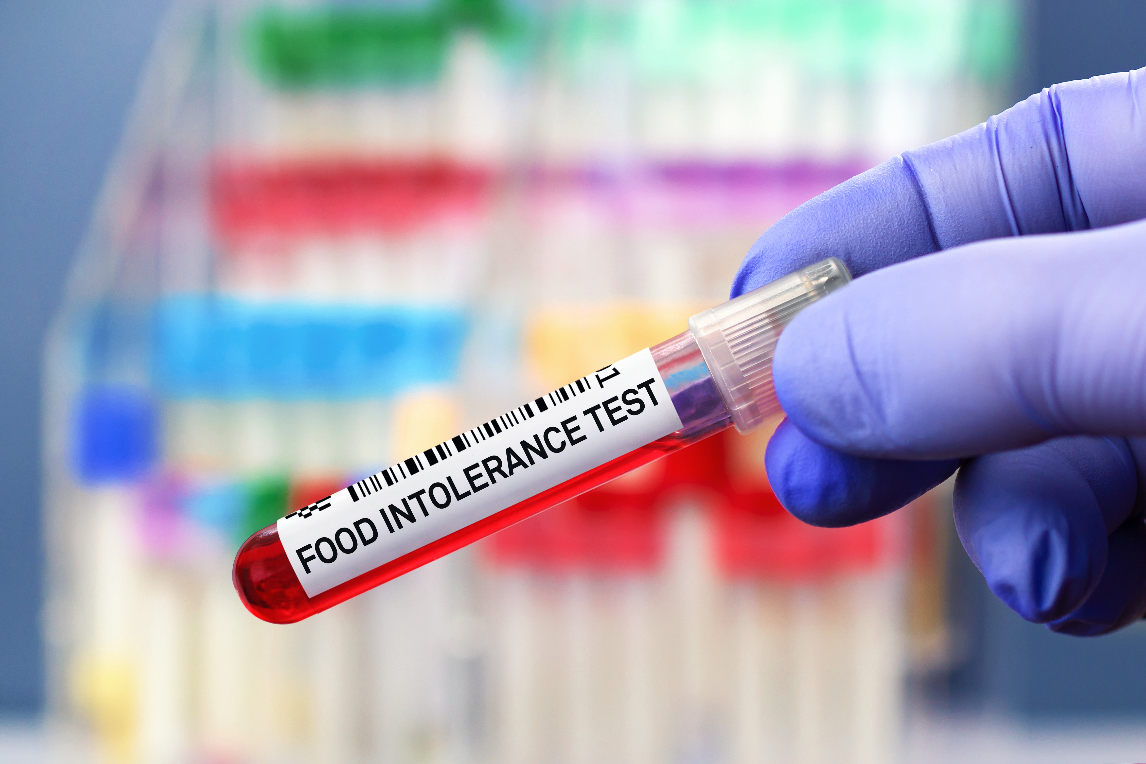 L'immunité acquise contre certains allergènes alimentaires protègerait-elle aussi, telle une immunité croisée contre le COVID-19 ? (Visuel Adobe Stock 492010366) L'immunité acquise contre certains allergènes alimentaires protègerait-elle aussi, telle une immunité croisée contre le COVID-19 ? (Visuel Adobe Stock 492010366)