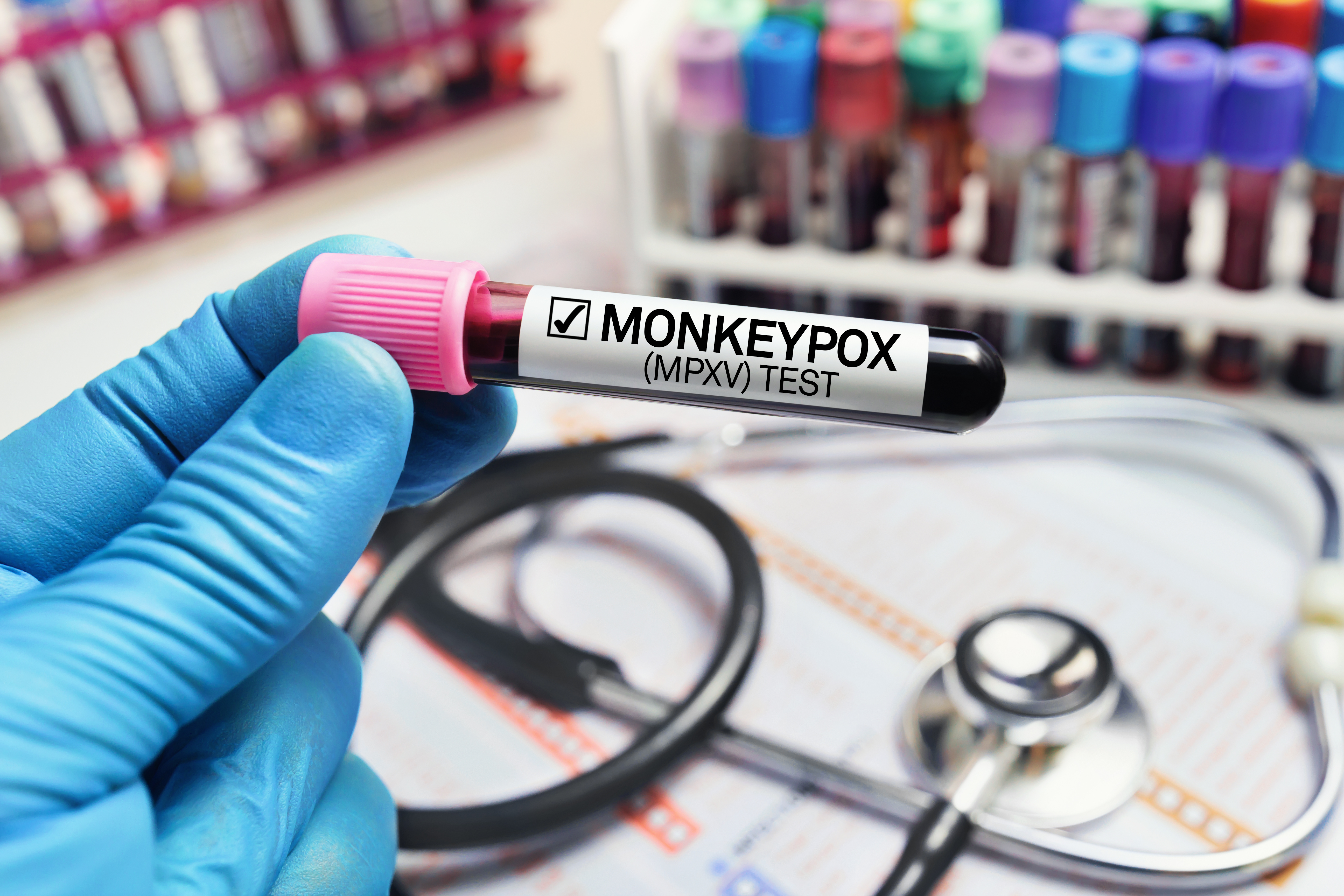 Monkey POX: il virus si nasconde nei testicoli