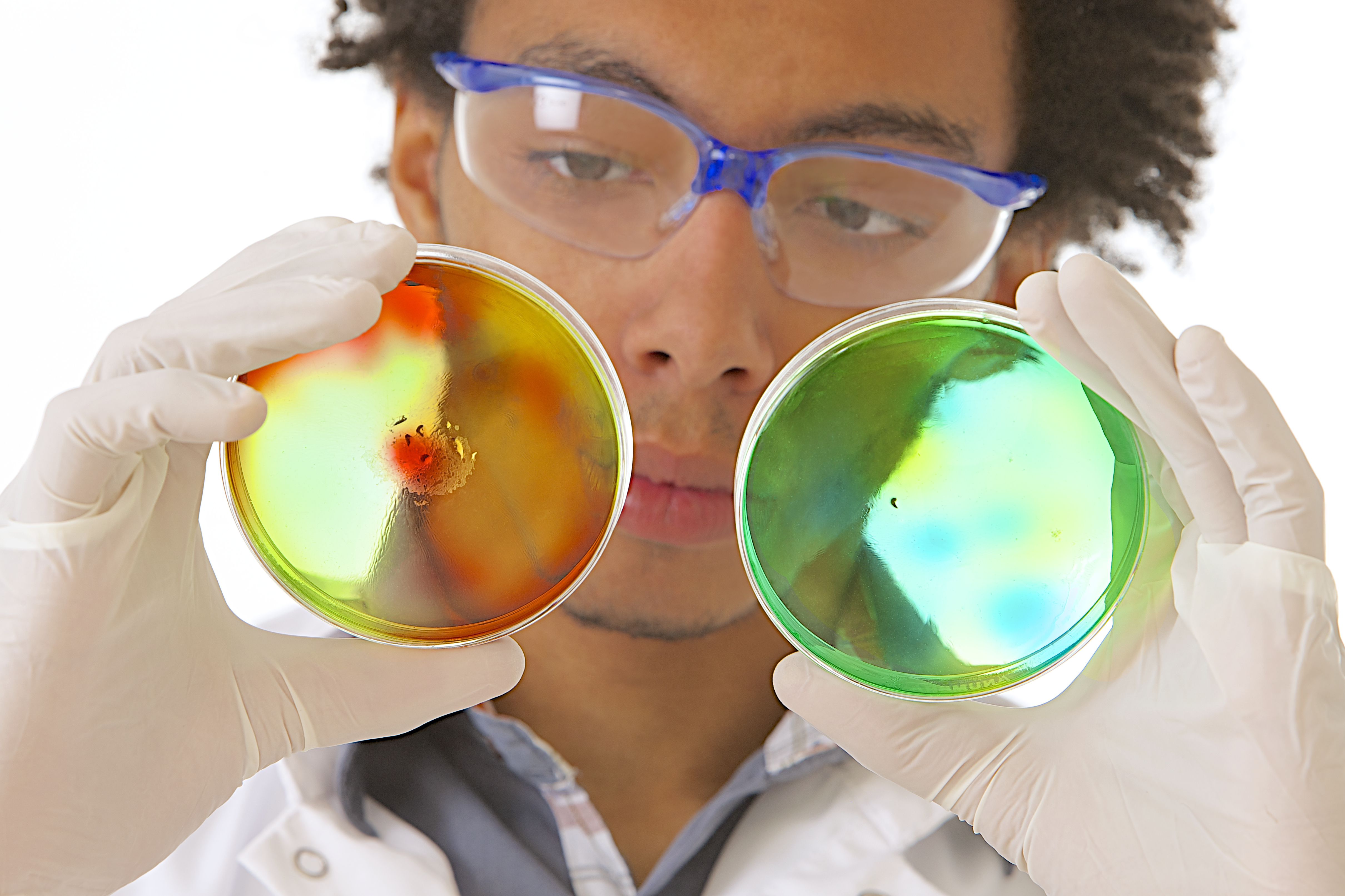 Les effets combinés du microbiote et de l’infection à SARS-CoV-2 dans les poumons, contribuent à expliquer la gravité de la maladie chez ces patients à comorbidités (Visuel AdobeStock_53717225). Les effets combinés du microbiote et de l’infection à SARS-CoV-2 dans les poumons, contribuent à expliquer la gravité de la maladie chez ces patients à comorbidités (Visuel AdobeStock_53717225).