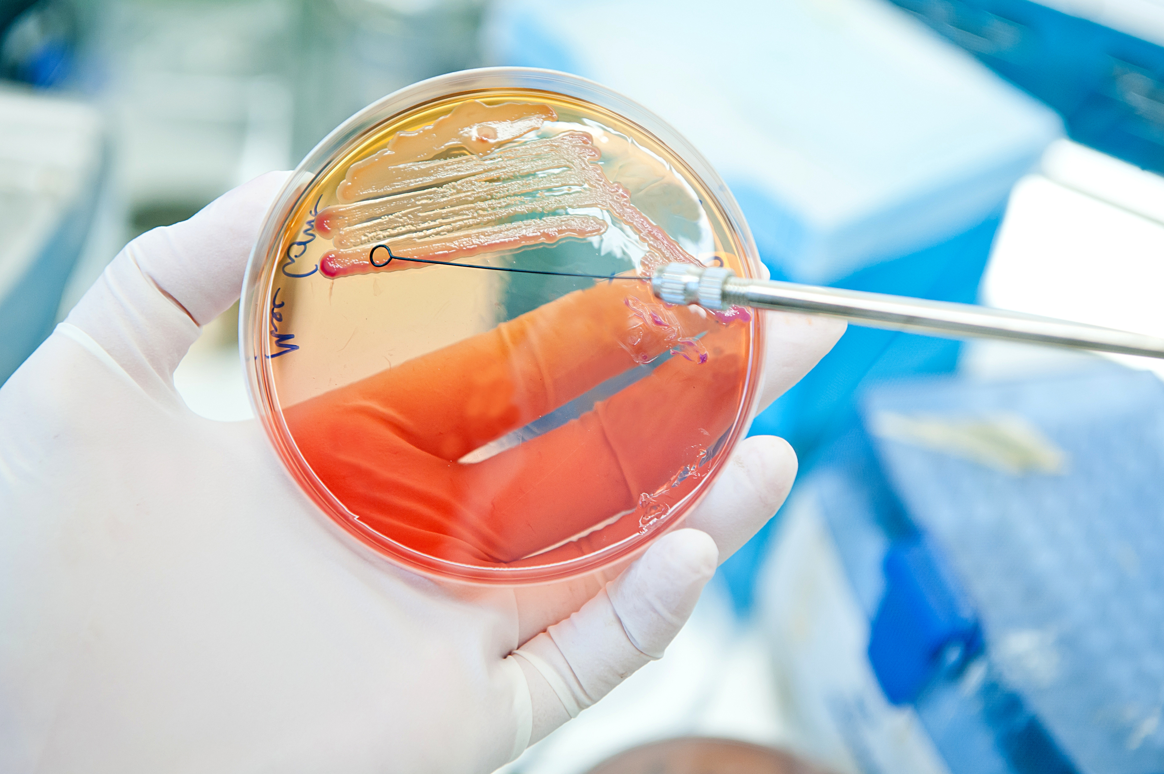 Une découverte qui présage du développement d'un probiotique permettant de contrer la perte musculaire avec l'âge (Visuel Adobe Stock 55246874) Une découverte qui présage du développement d'un probiotique permettant de contrer la perte musculaire avec l'âge (Visuel Adobe Stock 55246874)
