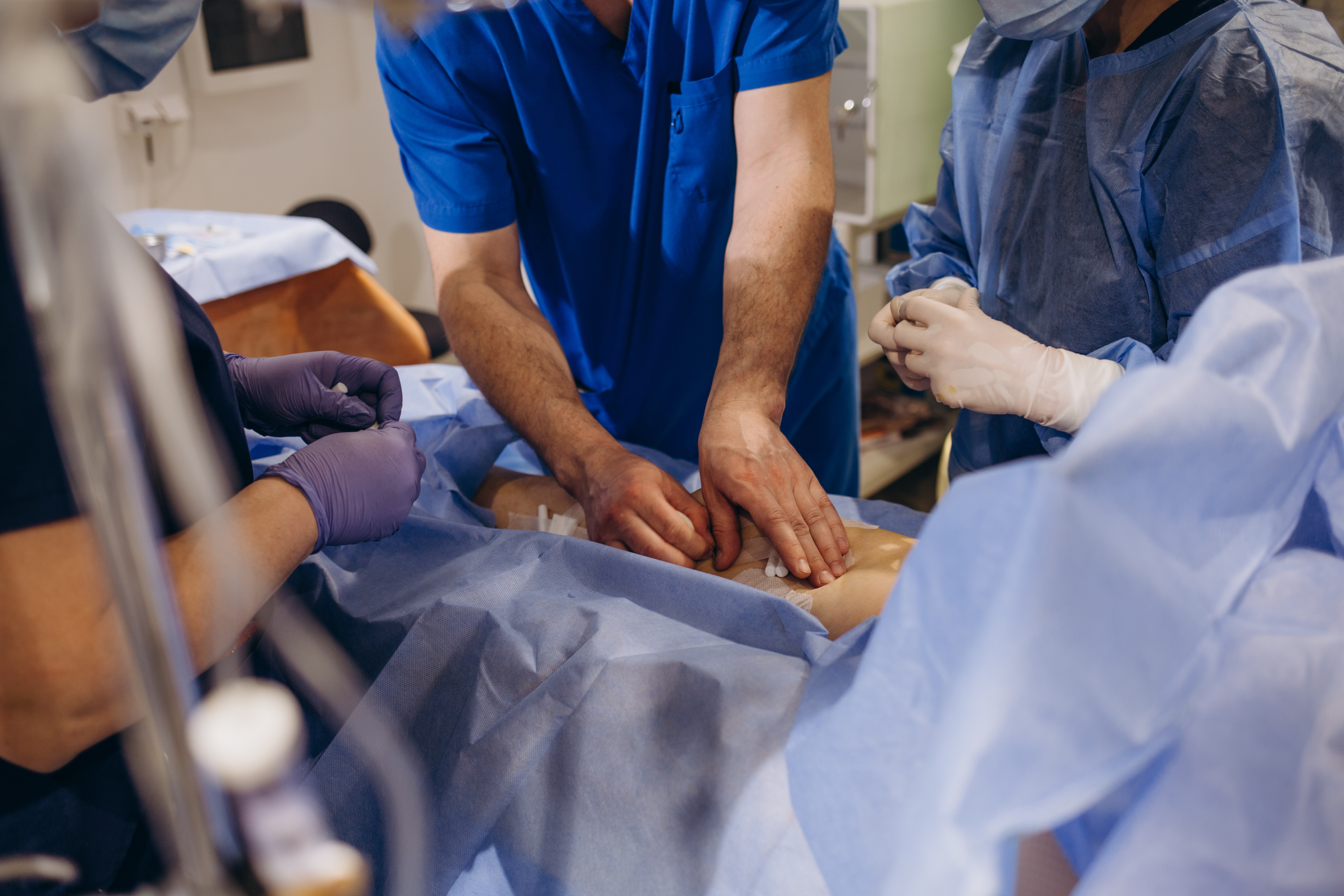 Une colle chirurgicale sécure et intelligente car dotée de capteurs, qui peut être utilisée pour fermer des plaies post-op intestinales (Visuel Adobe Stock 591399414) 