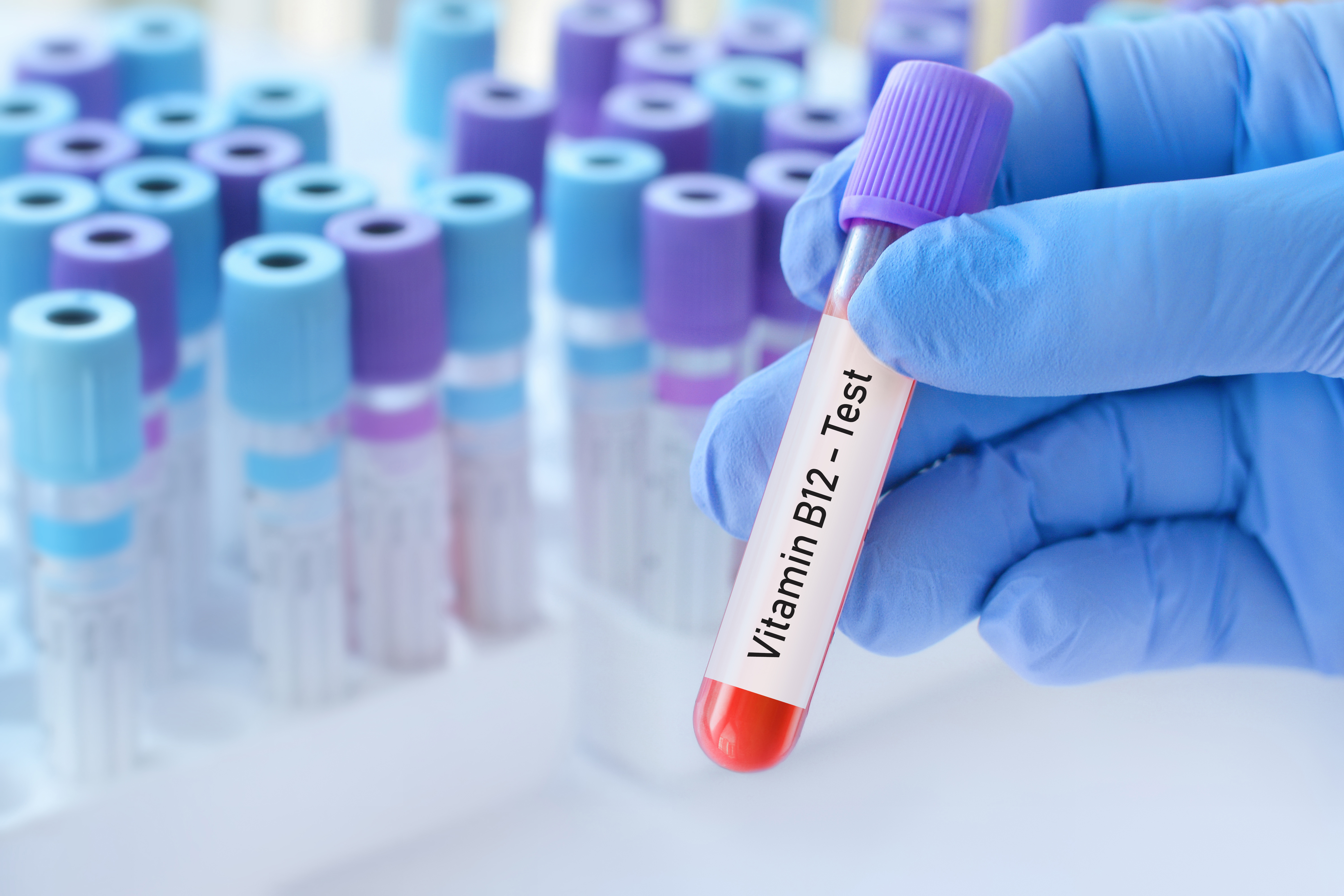 L’impact du taux de vitamine D sur le risque de diabète, pourrait dépendre des polymorphismes des récepteurs de la vitamine D (Visuel Adobe Stock 592611943).