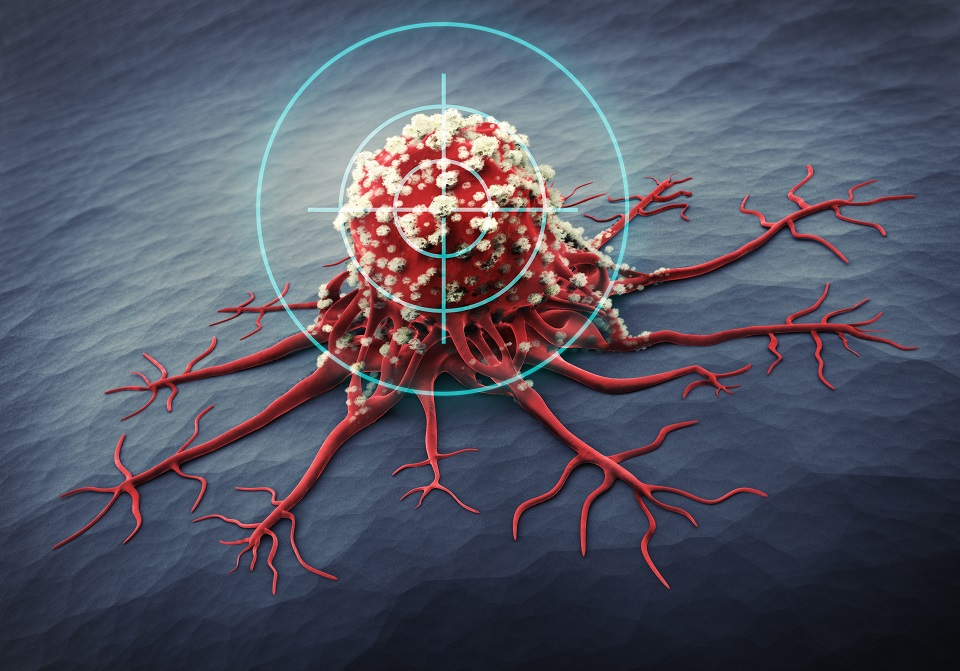 Il est grand besoin d’alternatives à la chimiothérapie pour le traitement de certains cancers et les essais cliniques devront confirmer ces premiers résultats prometteurs du « métallocifène ». Il est grand besoin d’alternatives à la chimiothérapie pour le traitement de certains cancers et les essais cliniques devront confirmer ces premiers résultats prometteurs du « métallocifène ».