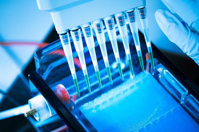 Les mutations cancéreuses surviennent parfois des décennies avant le diagnostic Les mutations cancéreuses surviennent parfois des décennies avant le diagnostic